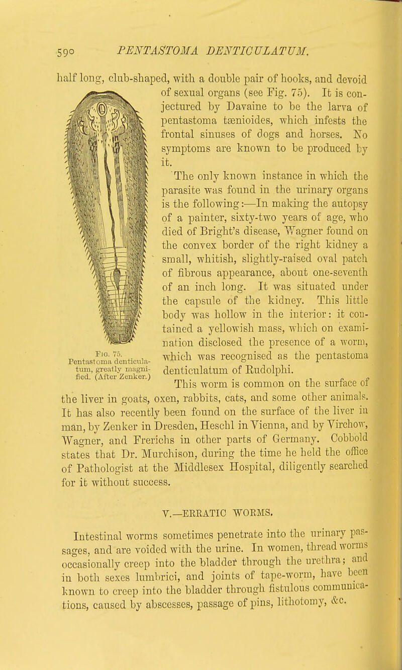 half long, club-shaped, with a double pair of hooks, and devoid of sexual organs (see Fig. 75). It is con- jectured by Davaine to be the larva of pentastoma tsenioides, which infests the frontal sinuses of dogs and horses. Kb symptoms are known to be produced by it. The only known instance in which the parasite was found in the urinary organs is the following:—In making the autopsy of a painter, sixty-two years of age, who died of Bright's disease, Wagner found on the convex border of the right kidney a small, whitish, slightly-raised oval patch of fibrous appearance, about one-seventh of an inch long. It was situated under the capsule of the kidney. This little body was hollow in the interior: it cou- tained a yellowish mass, which on exami- nation disclosed the presence of a worm, which was recognised as the pentastoma denticulatum of Eudolphi. This worm is common on the surface of the liver in goats, oxen, rabbits, cats, and some other animals. It has also recently been found on the surface of the liver in man, by Zenker in Dresden, Heschl in Vienna, and by Virchow, Wagner, and Frerichs in other parts of Germany. Cobbold states that Dr. Murchison, during the time he held the office of Pathologist at the Middlesex Hospital, diligently searched for it without success. Fig. 75. Pentastomii denticula- tum, greatly magni- fied. (After Zenker.) V.—ERRATIC WORMS. Intestinal worms sometimes penetrate into the urinary pas- sages, and are voided with the urine. In women, thread worms occasionally creep into the bladder through the urethra; ami in both sexes lumbrici, and joints of tape-worm, have beefl known to creep into the bladder through fistulous commuuica- tions, caused by abscesses, passage of pins, lithotomy, &c