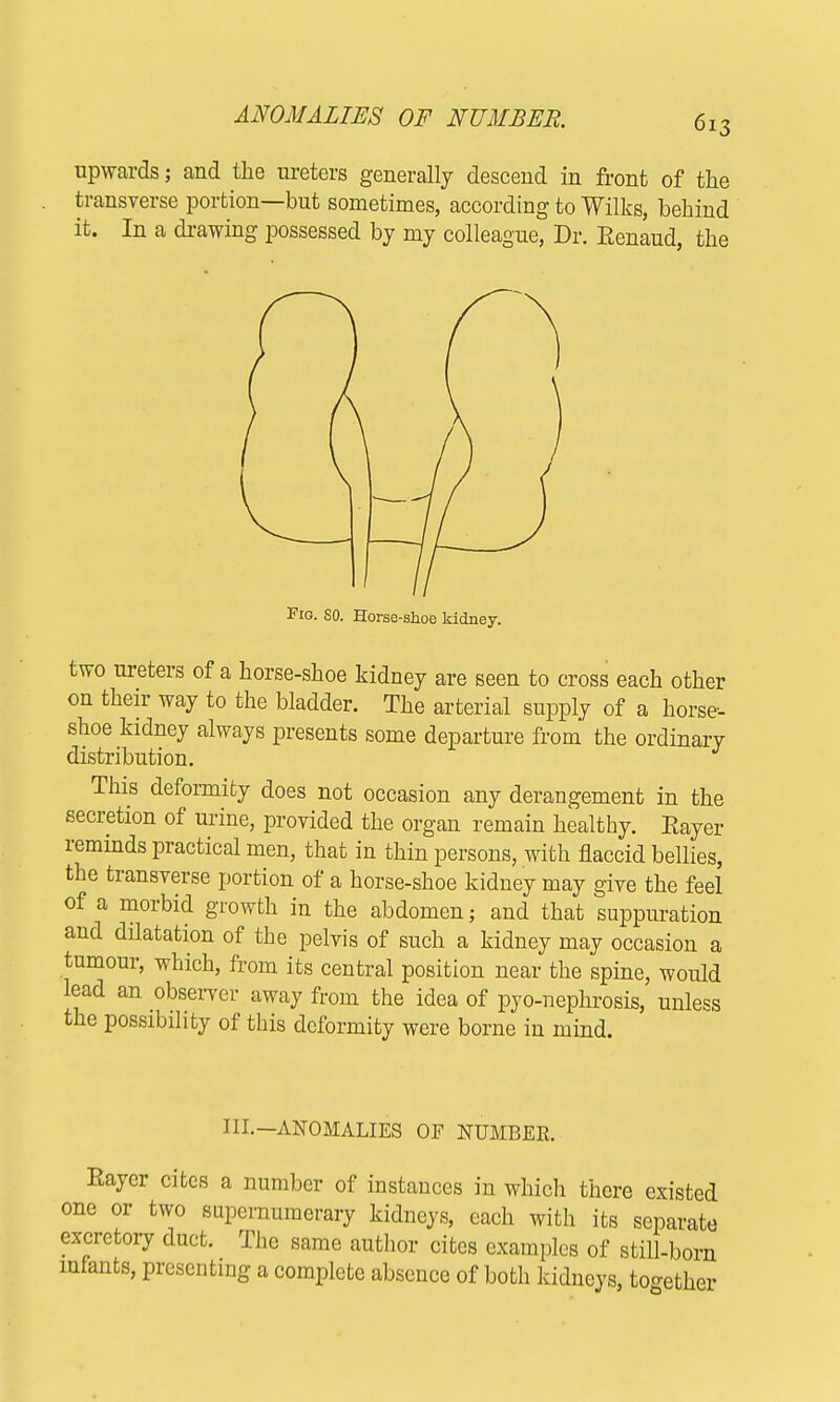 upwards; and the ureters generally descend in front of the transverse portion—but sometimes, according to Wilks, behind it. In a drawing possessed by my colleague, Dr. Eenaud, the Fig. SO. Horse-shoe kidney. two ureters of a horse-shoe kidney are seen to cross each other on their way to the bladder. The arterial supply of a horse- shoe kidney always presents some departure from the ordinary distribution. This deformity does not occasion any derangement in the secretion of urine, provided the organ remain healthy. Bayer reminds practical men, that in thin persons, with flaccid bellies, the transverse portion of a horse-shoe kidney may give the feel of a morbid growth in the abdomen; and that suppuration and dilatation of the pelvis of such a kidney may occasion a tumour, which, from its central position near the spine, would lead an observer away from the idea of pyo-nephrosis, unless the possibility of this deformity were borne in mind. III.—ANOMALIES OF NUMBER. Rayer cites a number of instances in which there existed one or two supernumerary kidneys, each with its separate excretory duct. The same author cites examples of still-born infants, presenting a complete absence of both kidneys, together