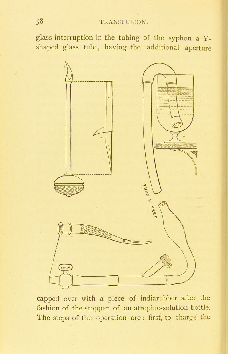 glass interruption in the tubing of the syphon a Y- shaped glass tube, having the additional aperture capped over with a piece of indiarubber after the fashion of the stopper of an atropine-solution bottle. The steps of the operation are : first, to charge the