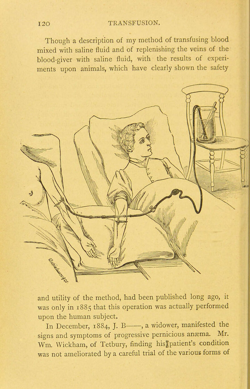 Though a description of my method of transfusing blood mixed with saline fluid and of replenishing the veins of the blood-giver with saline fluid, with the results of experi- ments upon animals, which have clearly shown the safety and utility of the method, had been published long ago, it was only in 1885 that this operation was actually performed upon the human subject. In December, 1884, J. B , a widower, manifested the signs and symptoms of progressive pernicious anasma. Mr. Wm. Wickham, of Tetbury, finding his|patient's condition was not ameliorated by a careful trial of the various forms of