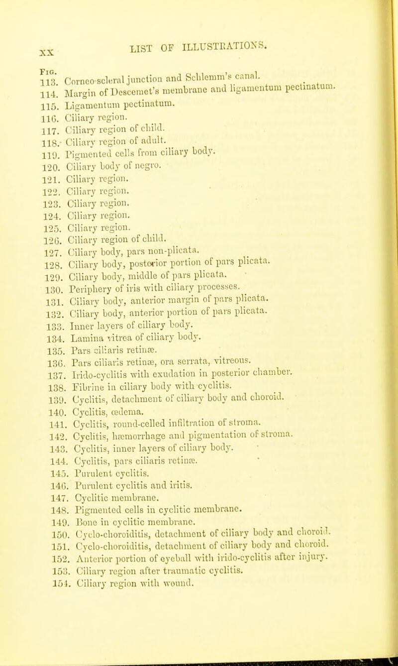 113. Corneo-scl«rnlji>nctioa and Sclilemm's canal. 114. Margin of Descemet's membrane and l.gamentum pectinatum. 115. Ligamentum pectinatum. IIG. Ciliary region. 117. Ciliary region of cliild. 118. - Ciliary region of adult. 119. Pigmented cells from ciliary body. 120. Ciliary body of negro. 121. Ciliary region. 122. Ciliary region. 123. Ciliary region. 124. Ciliary region. 125. Ciliary region. 12G. Ciliary region of cMld. 127. Ciliary body, pars non-plicata. 128. Ciliary body, posterior portion of pars plicata. 129. Ciliary body, middle of pars plicata. 130. Periphery of iris witb ciliary processes. 131. Ciliary body, anterior margin of pars plicata. 132. Ciliary body, anterior portion of pars plicata. 133. Inner layers of ciliary body. 134. Lamina vitrea of ciliary body. 135. Pars oiliaris retina;. 13G. Pars ciliaris retinas, ora scrrata, vitreous. 137. Irido-cyclitis -with exudation in posterior chamber. 138. Fibrine in ciliary body with cyclitis. 139. Cyclitis, detachment of ciliary body and choroid. 140. Cyclitis, cedema. 141. Cyclitis, round-celled infiltration of slroma. 142. Cyclitis, hajmorrhage and pigmentation of slroma. 143. Cyclitis, inner layers of ciliary body. 144. CycHtis, pars ciliaris rotiuoj. 143. Purulent cyclitis. 140. Purulent cyclitis and iritis. 147. Cychtic membrane. 148. Pigmented cells in cyclitic membrane. 149. Bone in cyclitic membrane. 150. Cyclo-choroidilis, detachment of ciliary body and choroid. 151. Cyclo-choroiditis, detachment of ciliary body and choroid. 152. Anterior portion of eyeball with irido-cyclitis after injury. 153. Ciliary region after traumatic cyclitis. 154. Ciliary region with wound.