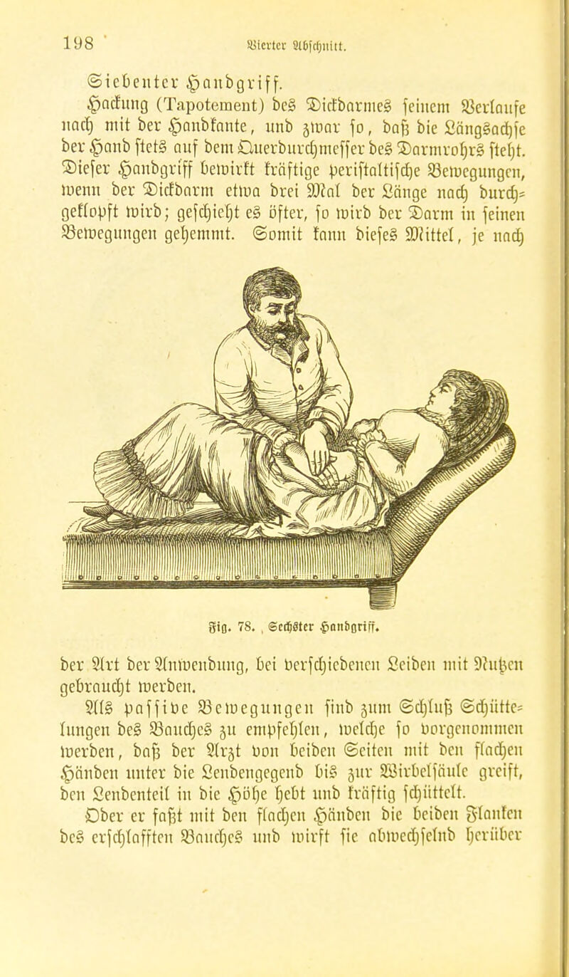 (Siebenter £>anbgrif f. Rodung (Tapotcment) be§ SMcfbarmeS feinem Verlaufe nad) mit ber £anbfnnte, unb jtoar fo, bafj bie £äng§ad)fe ber £anb ftetS auf bem Duerburdjmeffer be§ ®armrof)r3 ftetjt. SDiefer ^nnbgri'ff bemirft fräftige periftaltifdje 23emegungcn, luenn ber ©icfbnrm ettua brei Wal ber Sänge nad) burd^ geflopft roirb; gefdjietjt e§ öfter, fo wirb ber ®arm in feinen ^Bewegungen geljemmt. (Somit fonn biefe§ Littel, je und) Sifl. 78. , ©cdjöter ^an&Btiff. ber SIrt ber Sdnuenbung, bei uerfdjicbencn Seiben mit Dhijjcn gebrnudjt werben. 3tt§ paffibe ^Bewegungen finb jum ©djlufc <Sd)ütte- tungen be§ $8aud)c§ ju empfehlen, metcfje fo vorgenommen Werben, bnf? ber Slrjt uon beiben (Seiten mit ben ffadjeu Rauben unter bie Senbengegenb bi§ jur SBirbelfäuIc greift, ben Senbenteit in bie £jöfje f)ebt unb fräfttg fdjüttclt. Ober er fafjt mit ben ffadjen Rauben bie beiben g-tanfen bc§ erfcb>fften SBnitdjcS unb wirft fie nbmedjfetnb [jeriiber