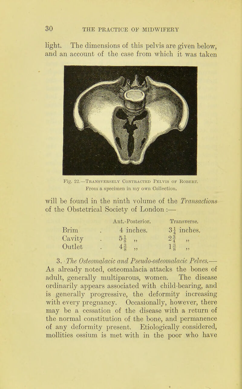 light. The dimensions of this pelvis are given below, and an account of the case from which it was taken Fig. 22.—Transversely Contracted Pelvis of Robert. From a specimen in my own Collection. will be found in the ninth volume of the Transactions of the Obstetrical Society of London :— Ant.-Posterior. Brim . 4 inches. Cavity . 5^ ,, Outlet . 4f „ 3. The Osteomalacic and Pseuclo-osteomalacic Pelves.— As already noted, osteomalacia attacks the bones of adult, generally multiparous, women. The disease ordinarily appears associated with child-bearing, and is generally progressive, the deformity increasing with every pregnancy. Occasionally, however, there may be a cessation of the disease with a return of the normal constitution of the bone, and permanence of any deformity present. Etiologically considered, mollities ossium is met with in the poor who have Transverse. 3| inches. 1 8 J'