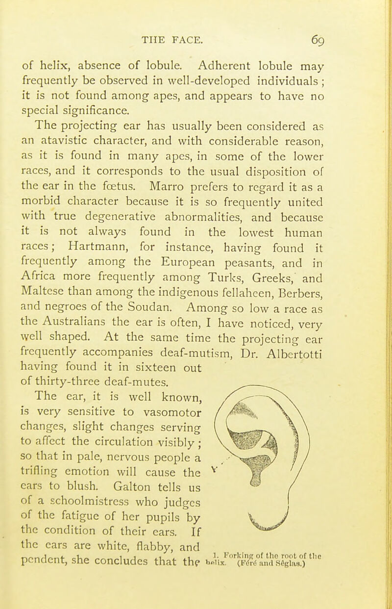 of helix, absence of lobule. Adherent lobule may frequently be observed in well-developed individuals ; it is not found among apes, and appears to have no special significance. The projecting ear has usually been considered as an atavistic character, and with considerable reason, as it is found in many apes, in some of the lower races, and it corresponds to the usual disposition of the ear in the fcetus. Marro prefers to regard it as a morbid character because it is so frequently united with true degenerative abnormalities, and because it is not always found in the lowest human races; Hartmann, for instance, having found it frequently among the European peasants, and in Africa more frequently among Turks, Greeks, and Maltese than among the indigenous fellaheen, Berbers, and negroes of the Soudan. Among so low a race as the Australians the ear is often, I have noticed, very well shaped. At the same time the projecting ear frequently accompanies deaf-mutism, Dr. Albertptti having found it in sixteen out of thirty-three deaf-mutes. The ear, it is well known, is very sensitive to vasomotor changes, slight changes serving to affect the circulation visibly ; so that in pale, nervous people a trifling emotion will cause the ears to blush. Galton tells us of a schoolmistress who judges of the fatigue of her pupils by the condition of their ears. If the ears are white, flabby, and pendent, she concludes that thf JyJ%^6%1.na%l^^^^^^