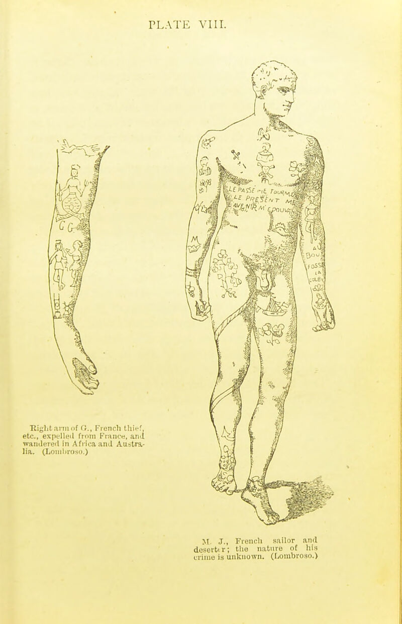 PLATE VIII. M. J., Fiencli sailor and deserttr; the nature of his Clime is unknown. (Lombroso.)
