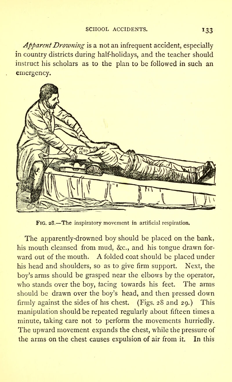 Apparent Drowning is a not an infrequent accident, especially in country districts during half-holidays, and the teacher should instruct his scholars as to the plan to be followed in such an emergency. Fig. 28.—The inspiratory movement in artificial respiration. The apparently-drowned boy should be placed on the bank, his mouth cleansed from mud, &c., and his tongue drawn for- ward out of the mouth. A folded coat should be placed under his head and shoulders, so as to give firm support. Next, the boy's arms should be grasped near the elbows by the operator, who stands over the boy, lacing towards his feet. The arms should be drawn over the boy's head, and then pressed down firmly against the sides of his chest. (Figs. 28 and 29.) This manipulation should be repeated regularly about fifteen times a minute, taking care not to perform the movements hurriedly. The upward movement expands the chest, while the pressure of the arms on the chest causes expulsion of air from it. In this