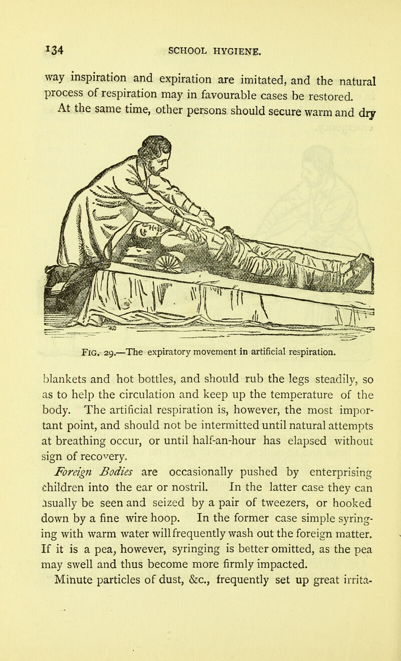 way inspiration and expiration are imitated, and the natural process of respiration may in favourable cases be restored. At the same time, other persons should secure warm and diy Fig. 29.—The expiratory movement in artificial respiration. blankets and hot bottles, and should rub the legs steadily, so as to help the circulation and keep up the temperature of the body. The artificial respiration is, however, the most impor- tant point, and should not be intermitted until natural attempts at breathing occur, or until half-an-hour has elapsed without sign of recovery. Foreign Bodies are occasionally pushed by enterprising children into the ear or nostril. In the latter case they can jsually be seen and seized by a pair of tweezers, or hooked down by a fine wire hoop. In the former case simple syring- ing with warm water will frequently wash out the foreign matter. If it is a pea, however, syringing is better omitted, as the pea may swell and thus become more firmly impacted. Minute particles of dust, &c., frequently set up great irrita-