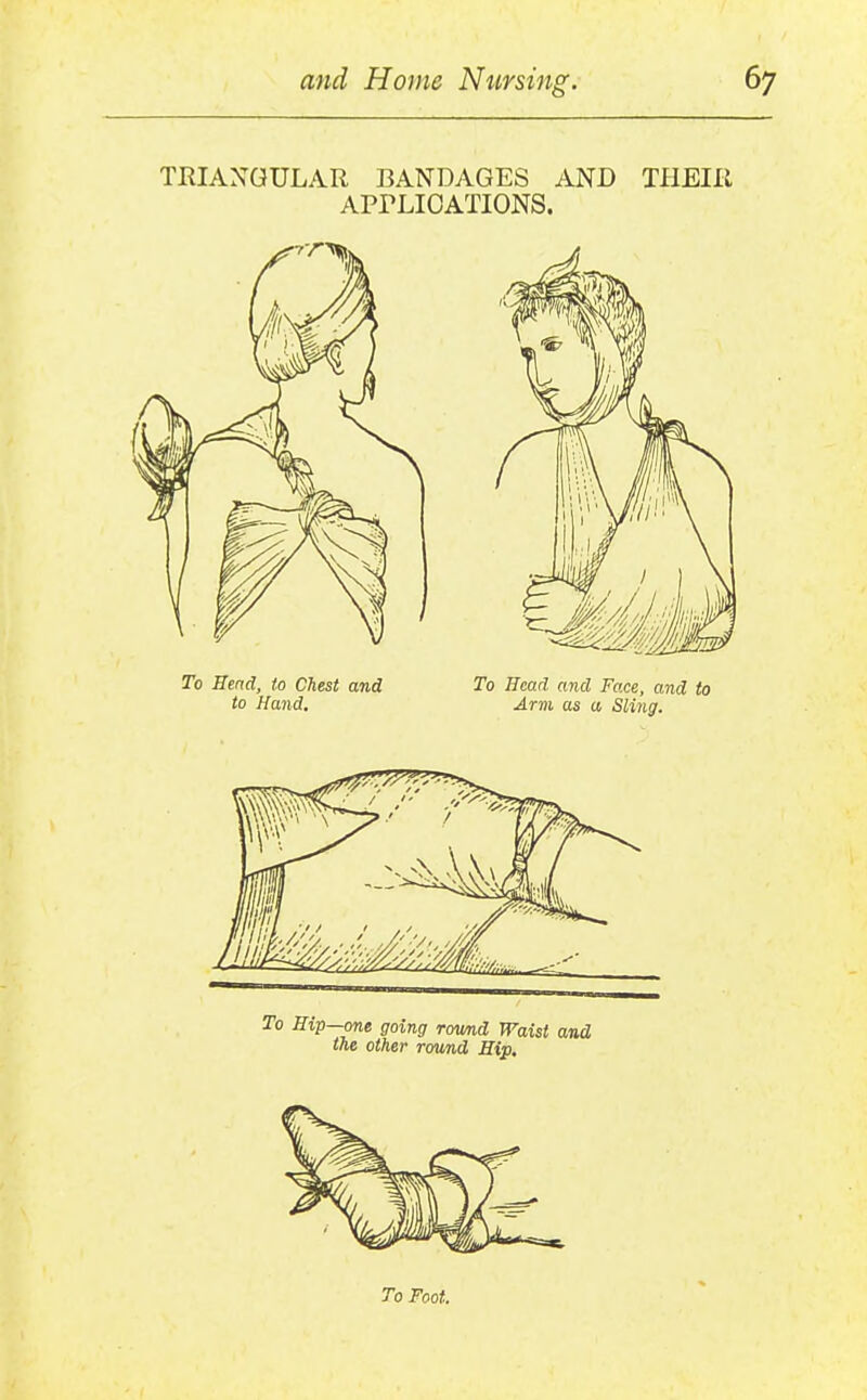 TRIAXGULAR BANDAGES AND THEIR APrLIOATIONS. To Bend, to Chest and To Head and Face, and to to Hand. Arm as a Sling. To Hip—one going round Waist and the other round Hip. To Foot.