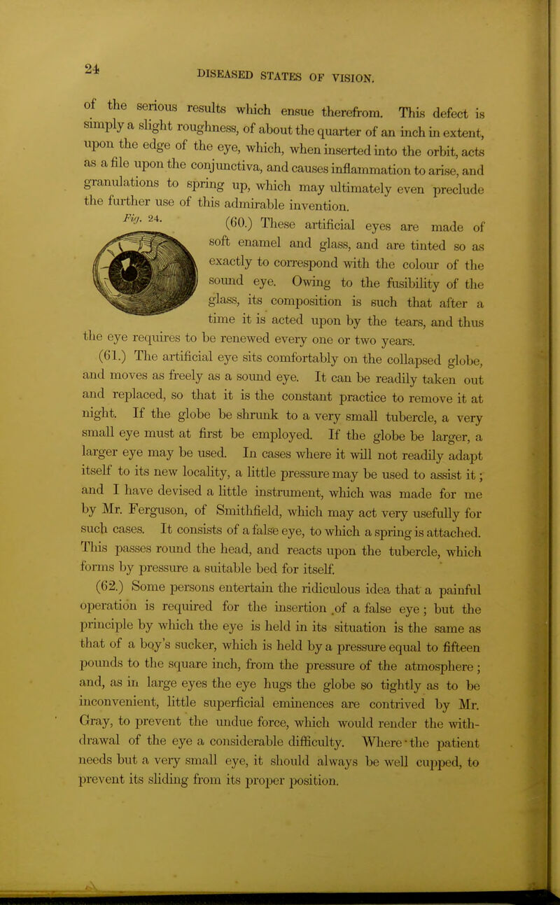 of the senous results which ensue therefrom. This defect is simply a slight roughness, of about the quarter of an inch in extent, upon the edge of the eye, which, when inserted into the orbit, acts as a file upon the conjunctiva, and causes inflammation to arise, and granulations to spring up, which may ultimately even preclude the further use of this admirable invention. (60.) These artificial eyes are made of soft enamel and glass, and are tinted so as exactly to con-espond with the colour of the sound eye. Owing to the fusibility of the glass, its composition is such that after a time it is acted upon by the tears, and thus the eye requires to be renewed every one or two years. (Gl.) The artificial eye sits comfortably on the collapsed globe, and moves as freely as a sound eye. It can be readily taken out and replaced, so that it is the constant practice to remove it at night. If the globe be shrunk to a very small tubercle, a very small eye must at first be employed. If the globe be larger, a larger eye may be used. In cases where it will not readily adapt itself to its new locality, a little pressure may be used to assist it; and I have devised a little instrument, which was made for me by Mr. Ferguson, of Smithfield, which may act very usefully for such oases. It consists of a false eye, to wliich a spring is attached. This passes round the head, and reacts upon the tubercle, which forms by pressure a suitable bed for itself, (62.) Some persons entertain the ridiculous idea that a painful operation is required for the insertion ,of a false eye; but the principle by wliich the eye is held in its situation is the same as that of a bqy's sucker, which is held by a pressure equal to fifteen pounds to the square inch, from the pressure of the atmosphere ; and, as in large eyes the eye hugs the globe so tightly as to be inconvenient, little superficial eminences are contrived by Mr. Gray, to prevent the undue force, which would render the with- drawal of the eye a considerable difiiculty. Wliere'the patient needs but a very small eye, it should always be well cupped, to prevent its sliding from its proper position.