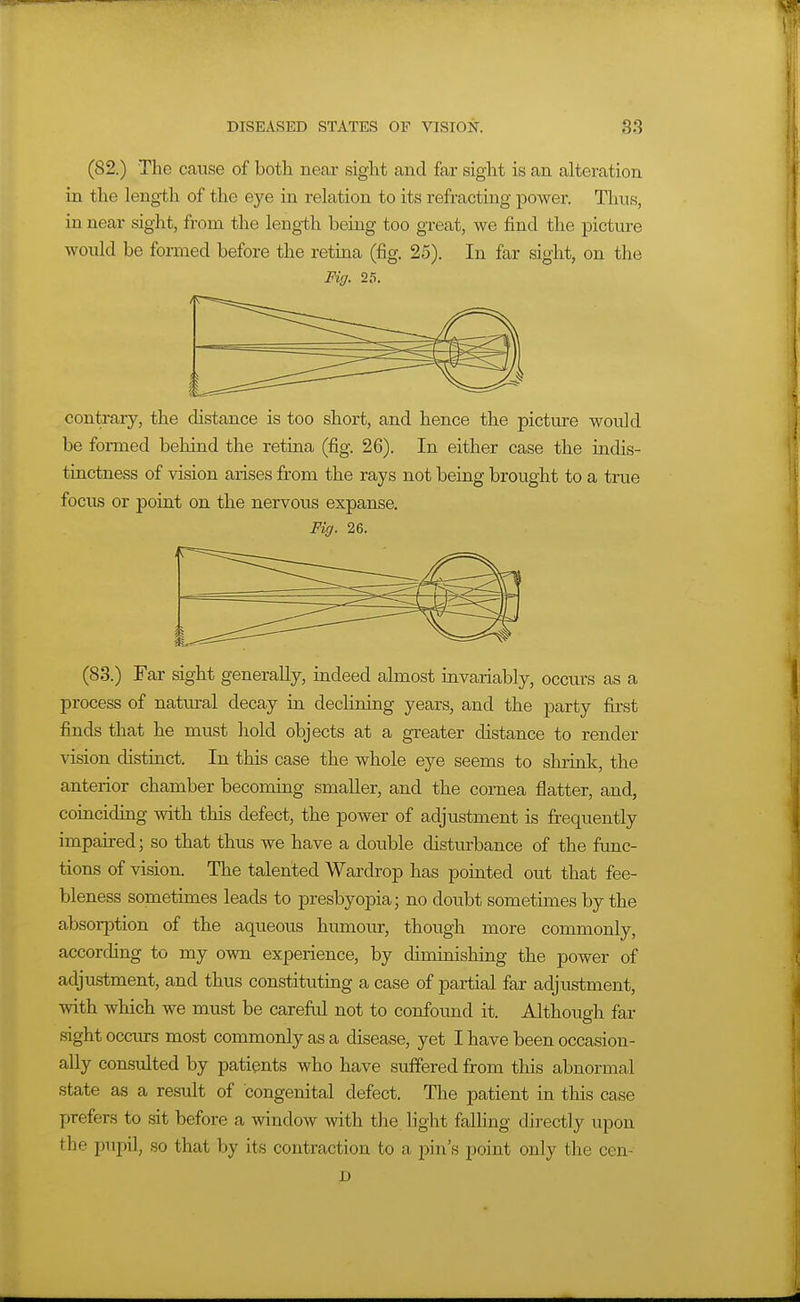 (82.) The cause of both near sight and far sight is an alteration in the length of the eye in relation to its refracting power. Thus, in near sight, from the length being too great, we find the picture would be formed before the retma (fig. 25). In far sight, on the Fig. 2.1. contrary, the distance is too short, and hence the picture would be formed behind the retina (fig. 26). In either case the indis- tinctness of vision arises from the rays not being brought to a true focus or point on the nervous expanse. Fig. 26. (83.) Far sight generally, indeed almost invariably, occurs as a process of natural decay in declining years, and the party first finds that he must hold objects at a greater distance to render vision distinct. In this case the whole eye seems to shrink, the anterior chamber becoming smaller, and the cornea flatter, and, coinciding with this defect, the power of adjustment is frequently impaired; so that thus we have a double disturbance of the func- tions of vision. The talented Wardrop has pointed out that fee- bleness sometimes leads to presbyopia; no doubt sometimes by the absorption of the aqueous humour, though more commonly, according to my own experience, by diminishing the power of adjustment, and thus constituting a case of partial far adjustment, with which we must be carefiil not to confound it. Although far sight occurs most commonly as a disease, yet I have been occasion- ally consulted by patients who have suffered from this abnormal state as a result of congenital defect. The patient in this case prefers to sit before a window with the light falhng directly upon the pupil, so that by its contraction to a pin's point only the cen- D