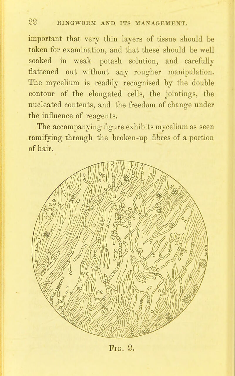 important that very thin layers of tissue should be taken for examination, and that these should be well soaked in weak potash solution, and carefully flattened out without any rougher manipulation. The mycelium is readily recognised by the double contour of the elongated cells, the jointings, the nucleated contents, and the freedom of change under the influence of reagents. The accompanying figure exhibits mycelium as seen ramifying through the broken-up fibres of a portion of hair. Fig. 2.