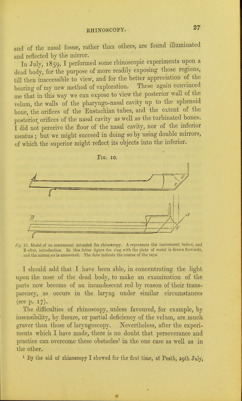 and of the nasal fossre, rather than others, are found illuminated and reflected by the mirror. In July, 1859, I performed some rhinoscopic experiments upon a dead body, for the purpose of more readily exposing those regions, till then inaccessible to view, and for the better appreciation of the bearing of my new method of exploration. These again convinced me that in this way we can expose to view the posterior wall of the velum, the walls of the pharyngo-nasal cavity up to the sphenoid bone, the orifices of the Eustachian tubes, and the extent of the posterior orifices of the nasal cavity as well as the turbinated bones. I did not perceive the floor of the nasal cavity, nor of the inferior meatus -, but we might succeed in doing so by using double mirrors, of which the superior might reflect its objects into the inferior. Fig. 10. Fig. 10. Mudel of an instrument intended for rhinoscopy. A. represents the instrument before, and B after, introduction. In this latter figure the ring with the plate of metal is drawn forwards, and the mirror as is uncovered. The dots indicate the course of the rays. I should add that I have been able, in concentrating the light upon the nose of the dead body, to make an examination of the pail s now become of an incandescent red by reason of their trans- parency, as occurs in the larynx under similar circumstances (see p. 17). The difficulties of rhinoscopy, unless favoured, for example, by insensibility, by fissure, or partial deficiency of the velum, are much graver than those of laryngoscopy. Nevertheless, after the experi- ments which I have made, there is no doubt that perseverance and practice can overcome these obstacles' in the one case as well as in the other. 1 By the aid of rhinoscopy I showed for the first time, at Pesth, 29th July,