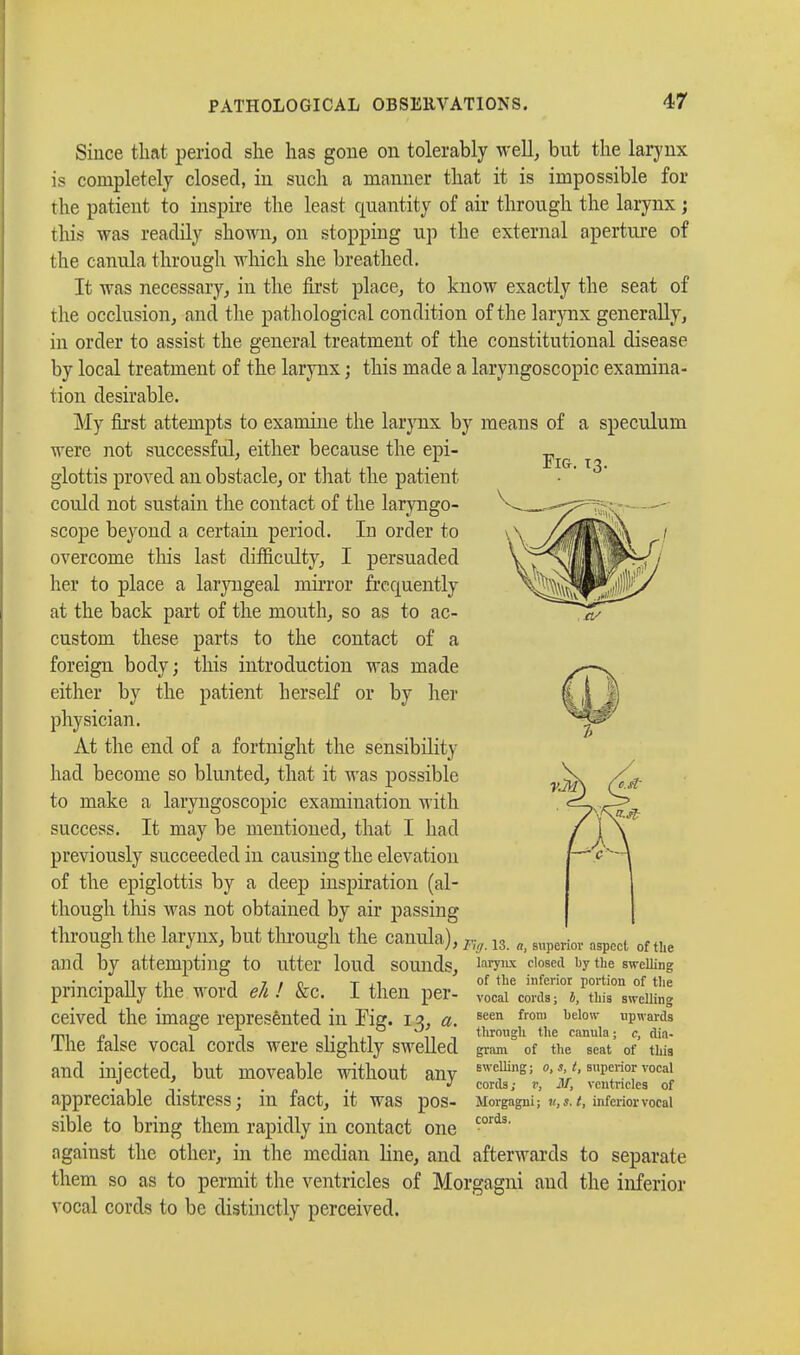 Fig. 13. (V Since that period she has gone on tolerably well, but the larynx is completely closed, in such a manner that it is impossible for the patient to inspire the least quantity of air through the larynx ; this was readily shown, on stopping up the external aperture of the canula through which she breathed. It was necessary, in the first place, to know exactly the seat of the occlusion, and the pathological condition of the larynx generally, in order to assist the general treatment of the constitutional disease by local treatment of the larynx ; this made a laryngoscopy examina- tion desirable. My first attempts to examine the larynx by means of a speculum were not successful, either because the epi- glottis proved an obstacle, or that the patient could not sustain the contact of the laryngo- scope beyond a certain period. In order to overcome tins last difficulty, I persuaded her to place a laryngeal mirror frequently at the back part of the mouth, so as to ac- custom these parts to the contact of a foreign body; this introduction was made either by the patient herself or by her physician. At the end of a fortnight the sensibility had become so blunted, that it was possible to make a laryngoscopy examination with success. It may be mentioned, that I had previously succeeded in causing the elevation of the epiglottis by a deep inspiration (al- though tins was not obtained by air passing through the larynx, but through the canula), and by attempting to utter loud sounds, principally the word eh ! &c. I then per- ceived the image represented in Fig. 13, a. The false vocal cords were slightly swelled and injected, but moveable without any appreciable distress; in fact, it was pos- sible to bring them rapidly in contact one against the other, in the median line, and afterwards to separate them so as to permit the ventricles of Morgagni and the inferior vocal cords to be distinctly perceived. Fh/. 13. a, superior aspect of the larynx closed by the swelling of the inferior portion of the vocal cords; I, this swelling seen from below upwards through the canula ; c, dia- gram of the seat of this swelling ; o, s, t, superior vocal cords; v, M, ventricles of Morgagni ; v, s. t, inferior vocal cords.