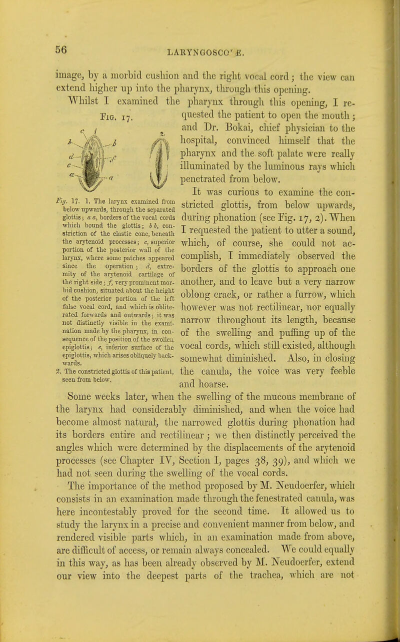 LAllYNGOSCO' E. image, by a morbid cushion and the right vocal cord ; the view can extend higher up into the pharynx, through this opening. Whilst I examined the pharynx through this opening, I rc- Fig. 17. quested the patient to open the mouth ; and Dr. Bokai, chief physician to the hospital, convinced himself that the pharynx and the soft palate were really illuminated by the luminous rays which penetrated from below. It was curious to examine the cou- Thc larynx examined from strif>terl frlnttis from hrlnw nmvarrU below upwards, through the separated SRlclecl glOttlS, TTOITI DeiOW Upwards, glottis ; a a, borders of the vocal cords during phonation (see Fig. 17, 2). When which bound the glottis: bb, con- t a 1 n j.1 î striction of the elastic cone, beneath 1 requested the patient to utter a sound, the arytenoid processes; c, superior which, of COUl'Se, she Could not ac- portion of the posterior wall of the . _ . , larynx, where some patches appeared COmpllsll, 1 immediately Observed the since the operation ; ,/ extre- borders of the glottis to approach one nnty of the arytenoid cartilage of 0 11 the right side ; f, very prominent mor- another, and to leave but a Very naiTOW olïSe SK?£SI oblong crack, or rather a furrow, which false vocal cord, and winch is obiite- however was not rectilinear, nor equally rated forwards and outwards; it was , i i , •■ 1 ,i i not distinctly visible in the exami- narrow throughout its length, because nation made by the pharynx, in con- 0f the Swelling and puffing Up of the sequence of the position of the swollen . . .V, .,, . , , epiglottis; e, inferior surface of the VOCal COl'ds, wllicll still existed, although epiglottis, which arises obliquely back- somewliat diminished. Also, ill closing wards. _ ' D 2. The constricted glottis of this patient, the cauula, the voice was very feeble seen from below. i i and hoarse. Some weeks later, when the swelling of the mucous membrane of the larynx had considerably diminished, and when the voice had become almost natural, the narrowed glottis during phonation had its borders entire and rectilinear ; Ave then distinctly perceived the angles which were determined by the displacements of the arytenoid processes (see Chapter IV, Section I, pages 38, 39), and which we had not seen during the swelling of the vocal cords. The importance of the method proposed by M. Neudoerfer, winch consists in an examination made through the fenestrated canula, was here incontestably proved for the second time. It allowed us to study the larynx in a precise and convenient manner from below, and rendered visible parts which, in an examination made from above, are difficult of access, or remain always concealed. We could equally in this way, as has been already observed by M. Neudoerfer, extend our view into the deepest parts of the trachea, which are not