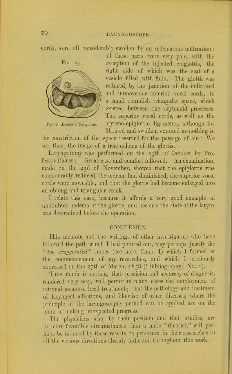 cords, were all considerably swollen by an (edematous infiltration : all these parts were very pale, with the Fig- 29. exception of the injected epiglottis, the right side of which was the seat of a vesicle filled with fluid. The glottis was reduced, by the junction of the infiltrated and immoveable inferior vocal cords, to a small roundish triangular space, which existed between the arytenoid processes. The superior vocal cords, as well as the %. 29. (Edema of the glottis. aryteno-epiglottic ligaments, although in- filtrated and swollen, counted as nothing in the constriction of the space reserved for the passage of air. We see, then, the image of a true oedema of the glottis. Laryngotomy was performed on the 29th of October by Pro- fessor Balassa. Great ease and comfort followed. An examination, made on the 23d of November, showed that the epiglottis was considerably reduced, the oedema had diminished, the superior vocal cords were moveable, and that the glottis had become enlarged into an oblong and triangular crack. I relate this case, because it affords a very good example of undoubted oedema of the glottis, , and because the state of the larynx was determined before the operation. CONCLUSION. This memoir, and the writings of other investigators who Lave followed the path which I had pointed out, may perhaps justify the too exaggerated hopes (see note, Chap. I) which I formed at the commencement of my researches, and which I previously expressed on the 27th of March, 1858 ('Bibliography/ No. 1). Thus much is certain, that precision and accuracy of diagnosis, rendered very easy, will permit in many cases the employment of rational means of local treatment; that the pathology and treat mem of laryngeal affections, and likewise of other diseases, where the principle, of the laryngoscopy method can be applied, are on the point of making unexpected progress. The physicians who, by their position and their studies, arc ill more favorable circumstances than a mere  theorist, will pel' haps be induced by these results to persevere in their researches in nil the various directions already indicated throughout this work.