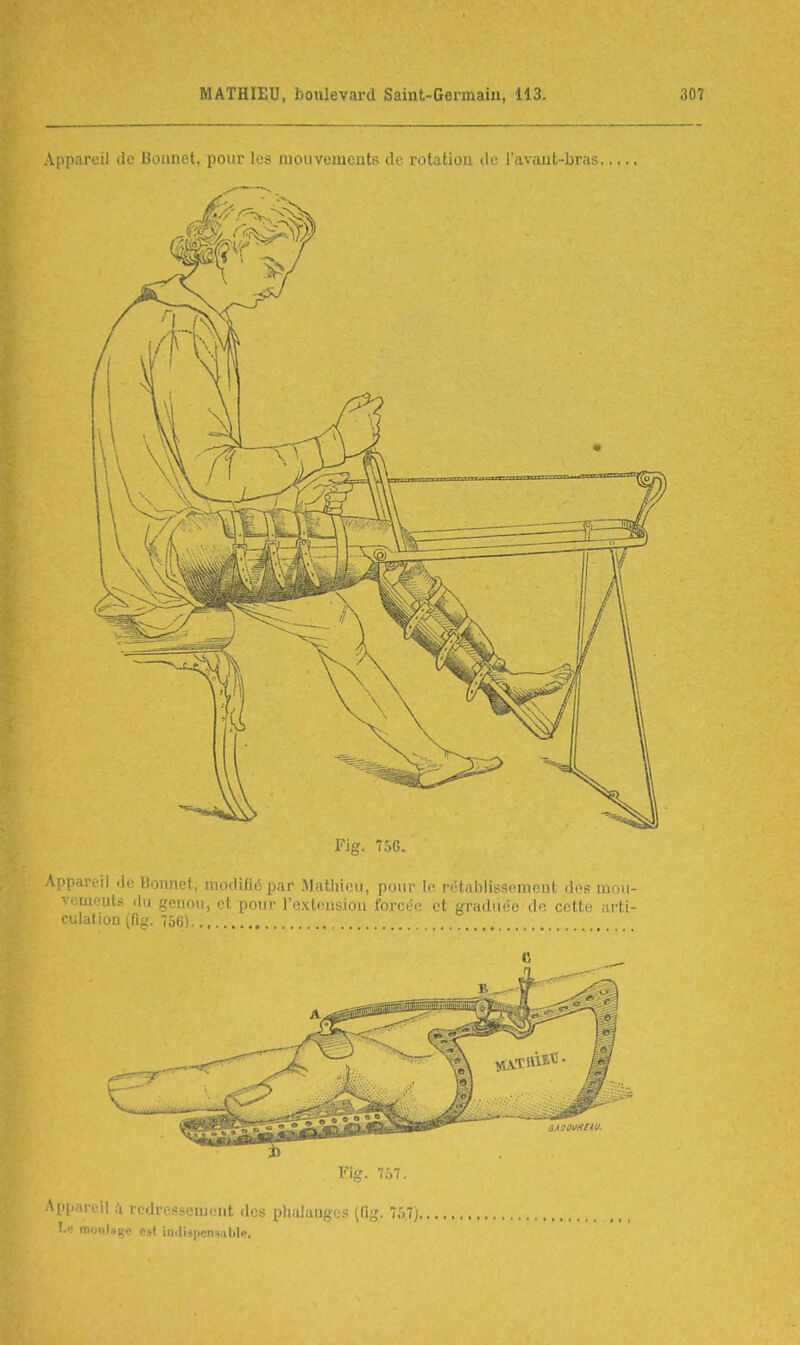 App-'i-' il .1. I! MipiM. pour les moiivumciifs i]r rotation de l'avaut-bras Fig. 757. App-'irt'il a rcdresseuicut des phalanges (fig. 75.7), ' • rn „,laiç(. est inilispcnsalil<>.