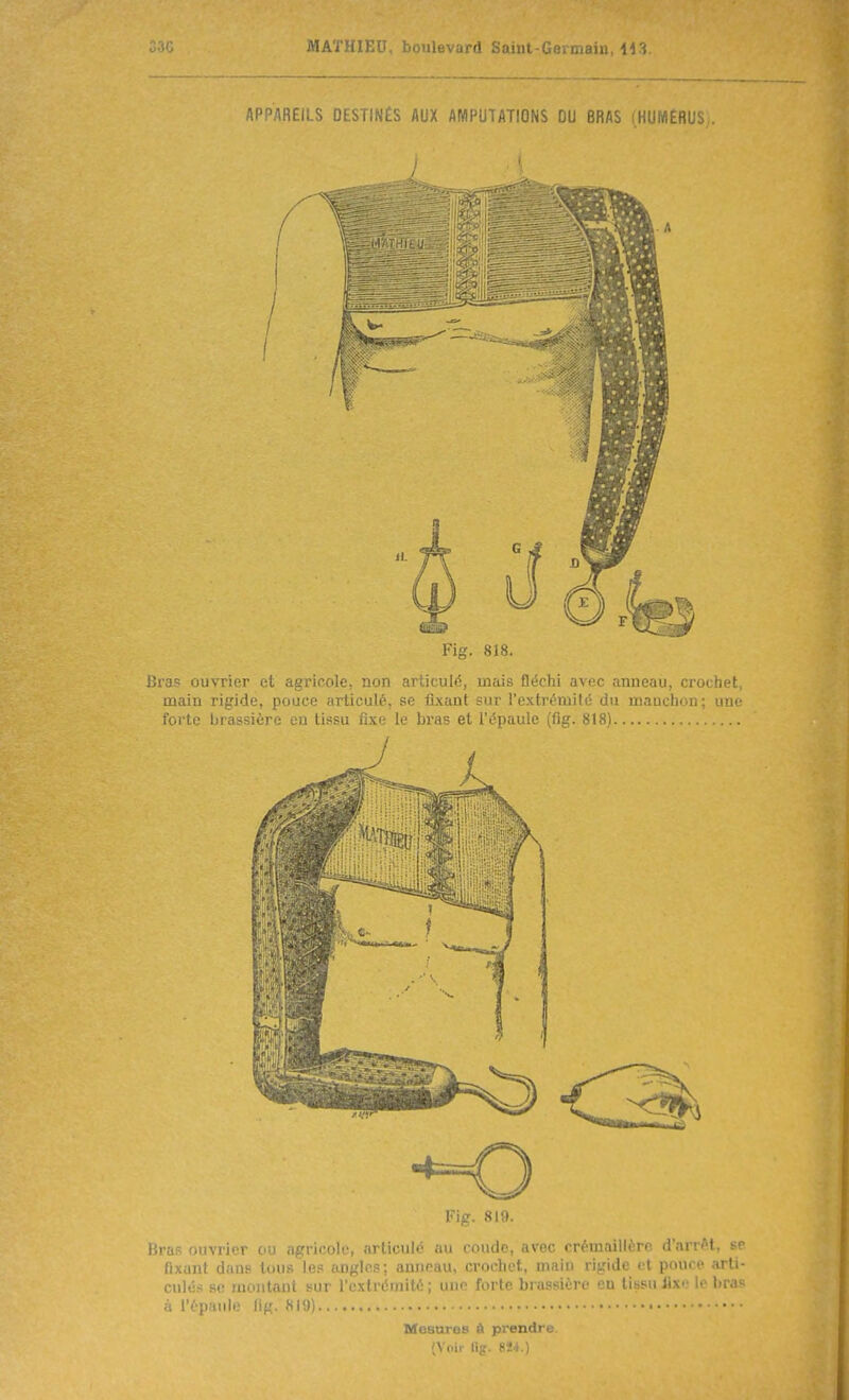 APPAREILS DESTINÉS AUX AMPUTATIONS DU BRAS (HUMÉRUS; Fig. 818. Bras ouvrier et agricole, non articulé, mais fléchi avec anneau, crochet, main rigide, pouce articulé, se fixant sur l'extréniilé du manchon; une forte brassière eu tissu fixe le bras et l'épaule (fig. 818) Fig. 819. Bras ouvrier ou agricole, articulé au coude, avec crémaillère d'arrAt, se fixant dans tous les angles; anneau, crochet, main rigide et pouce arti- cules se uuiiitaul sur l'extrémité; une forte brassière tissu lix.- le l.r.T^ à l'épaule lig. 819) Mosaros à prendre (Voir llp. 8Î4.)