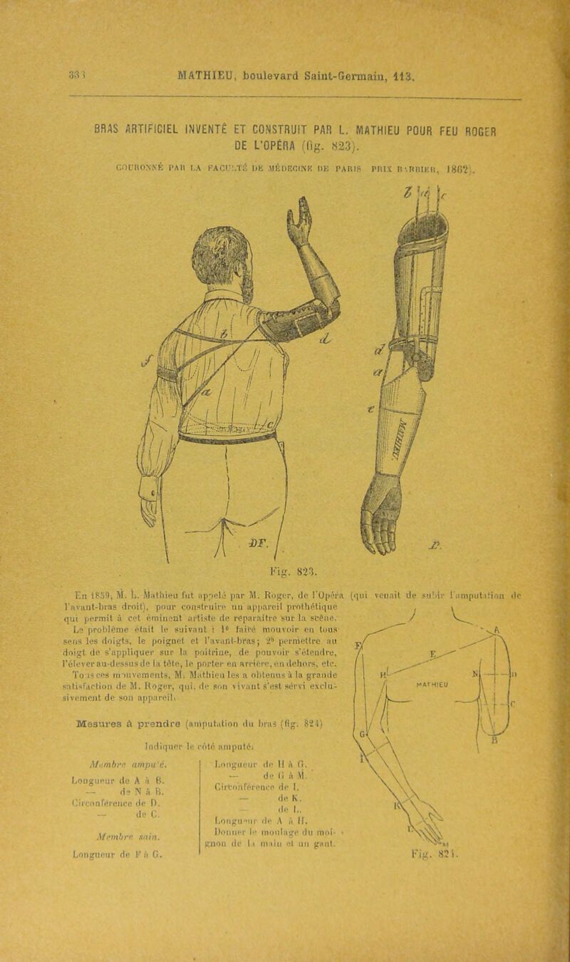 BRAS ARTIFICIEL mifilt ET CONSTRUIT PAR L. MATHIEU POUR FEU ROGER DE L'OPÉRA (fig. 823). COLHONXË l>,\M I,A KACU:,Té DE MÉDIîni.MC DE PARIR PlUX n-.niiiKii, 1802;. Fi''. 8-23. 1^11 IKV), M. L. iVhiHiieu lut iip-ielo par M. Rogc r, de l'Opi-ra (lui l nvanl-bras droit), pour coiisiruin? nu appareil prolliétiqiie (]ui permit à cet émiiiont artiste de reparaître sur la scôiie. Ln prolilërne était le suivant i I' laii'é mouvoir eu ti)U.s sens les doigts, le poignet et l'avant-bfas ; i pernictlre au doigt de s'appliquer sur la poitrine, de pouvoir s'étendre, l'élever au-dessus de la tiile, le porter en arrière, en dehors, etc. To isees nnuverneiits. M; Mathieu les a olilenus à la grande sati<l'artion de M. Ftoger, qui, de son vivant s'est sérvi exelu- .îîvemciit de son appareil, Mesvires à prendre (anlput.Ltlon du lirai (flg: iî\) Indiquer le roté nniputéi vcuait Mrimbrn ampu'é. Longueur do A à B. d? N il R. Oircoariireiice de D. - de C. Afpmbre sain. Longueur de K A C. Longueur de II A fi. — de (i à Ai. Cirt^o'nWrcnee de I. deK. I.. Luii^ii A à II. Donner le moulage du moi- Knon lie l.i main et un gant. FiK. 82i.