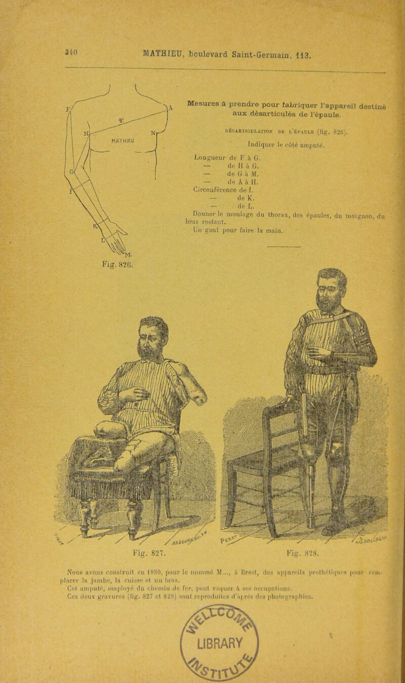 Mesures à prendre pour laLriquer Tapparell destiné aux désarticulés de l'épaule. IiLSARTICULATrON UE l'ÉCÀDLE (fig. 8ï«y. Indiquer le oôté amputé. Longueur de F à G. — de H il G. — do G à iM. — de A à II. Circonférence de I. — de K. — de L. Donner le moulage du tliorai, des épaules, du moignon, éu liras restant. Un gant pour faire la main. Fig. 827. Fig. .SÎS. Nous avons construit un 1880, pour le nommé M..., ii Bre.st, dos npparciU ppothéliquo.» pour ii'in placer la jnnibe, la cuiss^^ et nti liras. Cet amputé, employé du clicniin de fer, peut vaquer h ses ncrupaliun;'. Ces (Icnic gravures (fig. 827 et 82H) sont reproduites d'ui rt^s di s plii)lni;rnphips.