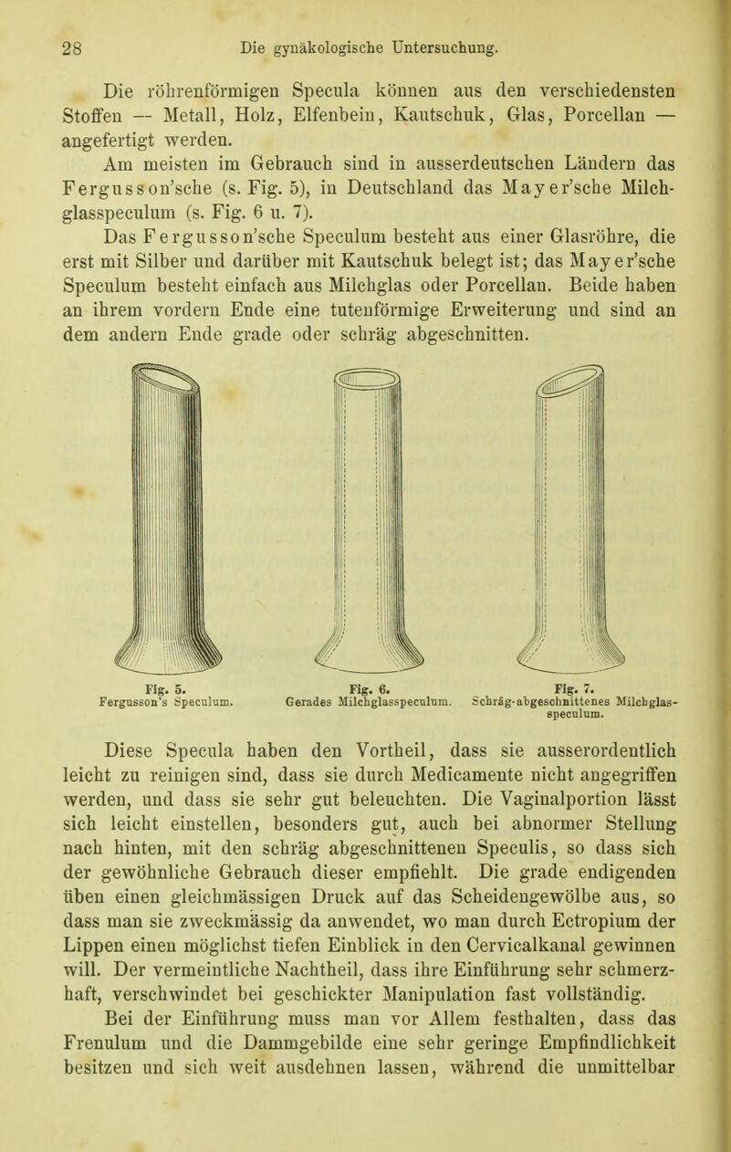 Die röhrenförmigen Specula können aus den verschiedensten Stoffen — Metall, Holz, Elfenbein, Kautschuk, Glas, Porcellan — angefertigt werden. Am meisten im Gebrauch sind in ausserdeutschen Ländern das Fergusson'sche (s. Fig. 5), in Deutschland das Mayer'sche Milch- glasspeculum (s. Fig. 6 u. 7). Das Fergusson'sche Speculum besteht aus einer Glasröhre, die erst mit Silber und darüber mit Kautschuk belegt ist; das Mayer'sche Speculum besteht einfach aus Milchglas oder Porcellan. Beide haben an ihrem vordem Ende eine tutenförmige Erweiterung und sind an dem andern Ende grade oder schräg abgeschnitten. Diese Specula haben den Vortheil, dass sie ausserordentlich leicht zu reinigen sind, dass sie durch Medicamente nicht angegriffen werden, und dass sie sehr gut beleuchten. Die Vaginalportion lässt sich leicht einstellen, besonders gut, auch bei abnormer Stellung nach hinten, mit den schräg abgeschnittenen Speculis, so dass sich der gewöhnliche Gebrauch dieser empfiehlt. Die grade endigenden üben einen gleichmässigen Druck auf das Scheidengewölbe aus, so dass man sie zweckmässig da anwendet, wo man durch Ectropium der Lippen einen möglichst tiefen Einblick in den Cervicalkanal gewinnen will. Der vermeintliche Nachtheil, dass ihre Einführung sehr schmerz- haft, verschwindet bei geschickter Manipulation fast vollständig. Bei der Einführung muss man vor Allem festhalten, dass das Frenulum und die Dammgebilde eine sehr geringe Empfindlichkeit besitzen und sich weit ausdehnen lassen, während die unmittelbar Fig. 5. Fergusson's Speculum.