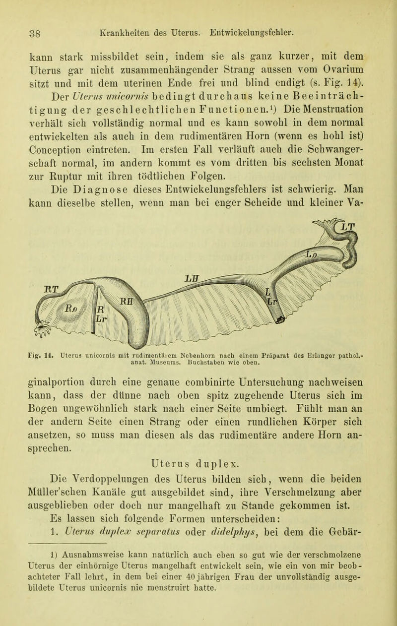 kann stark missbildet sein, indem sie als ganz kurzer, mit dem Uterus gar nicht zusammenhängender Strang aussen vom Ovarium sitzt und mit dem uterinen Ende frei und blind endigt (s. Fig. 14). Der Uterus unicornis bedingt durchaus keine Beeinträch- tigung der geschlechtlichen Functionen.1) Die Menstruation verhält sich vollständig normal und es kann sowohl in dem normal entwickelten als auch in dem rudimentären Horn (wenn es hohl ist) Conception eintreten. Im ersten Fall verläuft auch die Schwanger- schaft normal, im andern kommt es vom dritten bis sechsten Monat zur Ruptur mit ihren tödtlichen Folgen. Die Diagnose dieses Entwickelungsfehlers ist schwierig. Man kann dieselbe stellen, wenn man bei enger Scheide und kleiner Va- Fig. 14. Uterus unicornis mit rudimentärem Nebenhorn nach einem Präparat des Erlanger pathol.- anat. Museums. Buchstaben wie oben. ginalportion durch eine genaue combinirte Untersuchung nachweisen kann, dass der dünne nach oben spitz zugehende Uterus sich im Bogen ungewöhnlich stark nach einer Seite umbiegt. Fühlt man an der andern Seite einen Strang oder einen rundlichen Körper sich ansetzen, so muss man diesen als das rudimentäre andere Horn an- sprechen. Uterus duplex. Die Verdoppelungen des Uterus bilden sich, wenn die beiden Müller'schen Kanäle gut ausgebildet sind, ihre Verschmelzung aber ausgeblieben oder doch nur mangelhaft zu Stande gekommen ist. Es lassen sich folgende Formen unterscheiden: 1. Uterus duplex separates oder didelphys, bei dem die Gebär- 1) Ausnahmsweise kann natürlich auch eben so gut wie der verschmolzene Uterus der einhörnige Uterus mangelhaft entwickelt sein, wie ein von mir beob- achteter Fall lehrt, in dem bei einer 40jährigen Frau der unvollständig ausge- bildete Uterus unicornis nie menstruirt hatte.