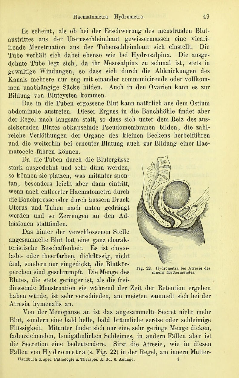 Es scheint, als ob bei der Erschwerung des menstrualen Blut- austrittes aus der Uterusschleimhaut gewissermassen eine vicari- irende Menstruation aus der Tubenschleimhaut sich einstellt. Die Tube verhält sich dabei ebenso wie bei Hydrosalpinx. Die ausge- dehnte Tube legt sich, da ihr Mesosalpinx zu schmal ist, stets in gewaltige Windungen, so dass sich durch die Abknickungen des Kanals mehrere nur eng mit einander communicirende oder vollkom- men unabhängige Säcke bilden. Auch in den Ovarien kann es zur Bildung von Blutcysten kommen. Das in die Tuben ergossene Blut kann natürlich aus dem Ostium abdominale austreten. Dieser Erguss in die Bauchhöhle findet aber der Regel nach langsam statt, so dass sich unter dem Reiz des aus- sickernden Blutes abkapselnde Pseudomembranen bilden, die zahl- reiche Verlöthungen der Organe des kleinen Beckens herbeiführen und die weiterhin bei erneuter Blutung auch zur Bildung einer Hae- matocele führen können. Da die Tuben durch die Blutergüsse stark ausgedehnt und sehr dünn werden, so können sie platzen, was mitunter spon- tan, besonders leicht aber dann eintritt, wenn nach entleerter Haematometra durch die Bauchpresse oder durch äussern Druck Uterus und Tuben nach unten gedrängt werden und so Zerrungen an den Ad- häsionen stattfinden. Das hinter der verschlossenen Stelle angesammelte Blut hat eine ganz charak- teristische Beschaffenheit. Es ist choco- lade- oder theerfarben, dickflüssig, nicht faul, sondern nur eingedickt, die Blutkör- perchen sind geschrumpft. Die Menge des Blutes, die stets geringer ist, als die frei- fiiessende Menstruation sie während der Zeit der Retention ergeben haben würde, ist sehr verschieden, am meisten sammelt sich bei der Atresia hymenalis an. Von der Menopause an ist das angesammelte Secret nicht mehr Blut, sondern eine bald helle, bald bräunliche seröse oder schleimige Flüssigkeit. Mitunter findet sich nur eine sehr geringe Menge dicken, fadenziehenden, honigähnlichen Schleimes, in andern Fällen aber ist die Secretion eine bedeutendere. Sitzt die Atresie, wie in diesen Fällen von Hydrometra (s. Fig. 22) in der Regel, am innern Mutter- Handbuch d. spec. Pathologie u. Therapie. X. Bd. 6. Auflage. 4 Fig. 22. Hydrometra hei Atresie des innern Muttermundes.