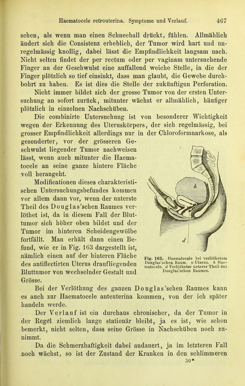 sehen, als wenn man einen Schneeball drückt, fühlen. Allmählich ändert sich die Consistenz erheblich, der Tumor wird hart und un- regelmässig knollig, dabei lässt die Empfindlichkeit langsam nach. Nicht selten findet der per rectum oder per vaginam untersuchende Finger an der Geschwulst eine auffallend weiche Stelle, in die der Finger plötzlich so tief einsinkt, dass man glaubt, die Gewebe durch- bohrt zu haben. Es ist dies die Stelle der zukünftigen Perforation. Nicht immer bildet sich der grosse Tumor von der ersten Unter- suchung an sofort zurück, mitunter wächst er allmählich, häufiger plötzlich in einzelnen Nachschüben. Die combinirte Untersuchung ist von besonderer Wichtigkeit wegen der Erkennung des Uteruskörpers, der sich regelmässig, bei grosser Empfindlichkeit allerdings nur in der Chloroformnarkose, als gesonderter, vor der grösseren Ge- schwulst liegender Tumor nachweisen lässt, wenn auch mitunter die Haema- tocele an seine ganze hintere Fläche voll herangeht. Modificationen dieses charakteristi- schen Untersuchungsbefundes kommen vor allem dann vor, wenn der unterste Theil des Douglas'schen Raumes ver- löthet ist, da in diesem Fall der Blut- tumor sich höher oben bildet und der Tumor im hinteren Scheidengewölbe fortfällt. Man erhält dann einen Be- fund, wie er in Fig. 163 dargestellt ist, nämlich einen auf der hinteren Fläche des antiflectirten Uterus draufliegenden Bluttumor von wechselnder Gestalt und Grösse. Bei der Verlöthung des ganzen Douglas'schen Raumes kann es auch zur Haematocele anteuterina kommen, von der ich später handeln werde. Der Verlauf ist ein durchaus chronischer, da der Tumor in der Regel ziemlich lange stationär bleibt, ja es ist, wie schon bemerkt, nicht selten, dass seine Grösse in Nachschüben noch zu- nimmt. Da die Schmerzhaftigkeit dabei andauert, ja im letzteren Fall noch wächst, so ist der Zustand der Kranken in den schlimmeren Fig. 163. Haematocele bei verlöthetem Douglasschen Raum, u Uterus, h Hae- matocele. d Verlötheter unterer Theil des Douglas'schen Baumes.