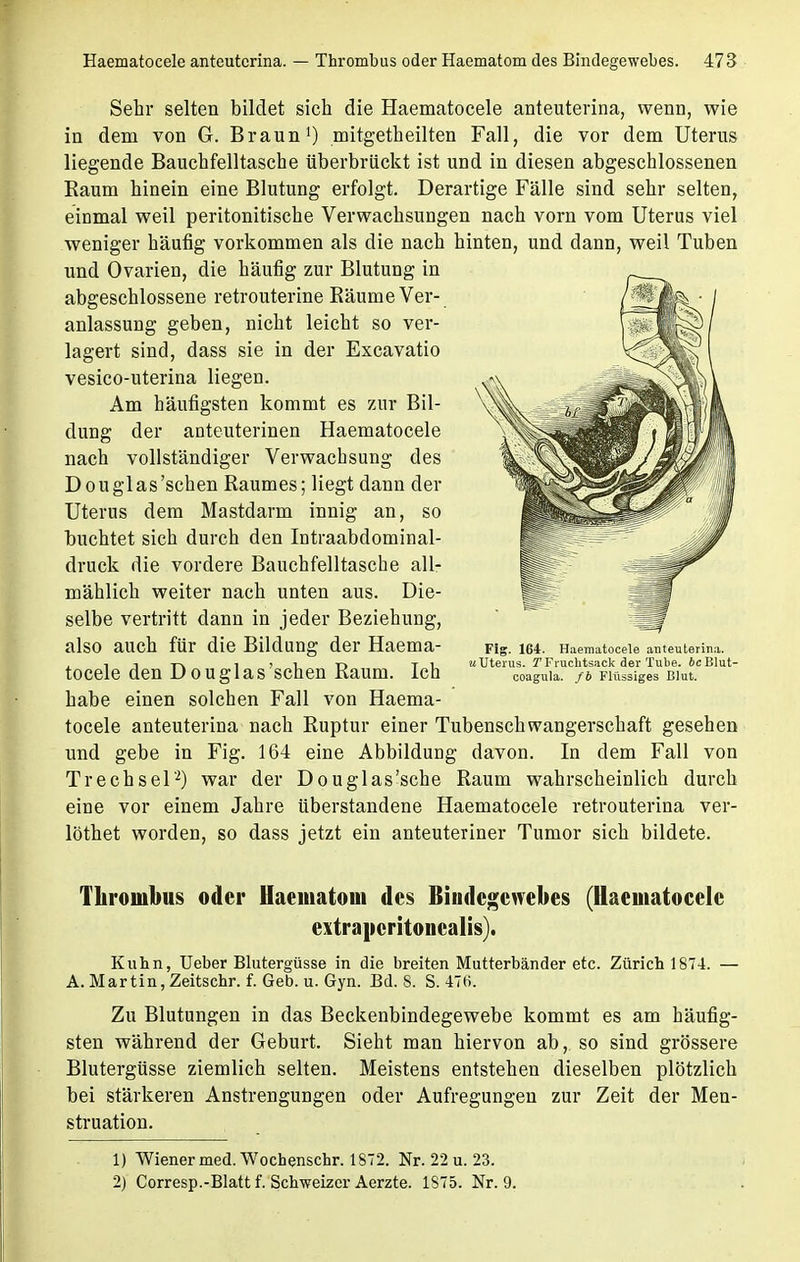 Sehr selten bildet sich die Haematocele anteuterina, wenn, wie in dem von G. Braun1) mitgetheilten Fall, die vor dem Uterus liegende Bauchfelltasche überbrückt ist und in diesen abgeschlossenen Raum hinein eine Blutung erfolgt. Derartige Fälle sind sehr selten, einmal weil peritonitische Verwachsungen nach vorn vom Uterus viel weniger häufig vorkommen als die nach hinten, und dann, weil Tuben und Ovarien, die häufig zur Blutung in abgeschlossene retrouterine Räume Ver- anlassung geben, nicht leicht so ver- lagert sind, dass sie in der Excavatio vesico-uterina liegen. Am häufigsten kommt es zur Bil- dung der anteuterinen Haematocele nach vollständiger Verwachsung des Douglas'sehen Raumes; liegt dann der Uterus dem Mastdarm innig an, so buchtet sich durch den Intraabdominal- druck die vordere Bauchfelltasche all- mählich weiter nach unten aus. Die- selbe vertritt dann in jeder Beziehung, also auch für die Bildung der Haema- tocele den D ouglas'sehen Raum. Ich habe einen solchen Fall von Haema- tocele anteuterina nach Ruptur einer Tubenschwangerschaft gesehen und gebe in Fig. 164 eine Abbildung davon. In dem Fall von Trechsel'2) war der Douglas'sche Raum wahrscheinlich durch eine vor einem Jahre überstandene Haematocele retrouterina ver- löthet worden, so dass jetzt ein anteuteriner Tumor sich bildete. Thrombus oder Haematom des Bindegewebes (Haematocele extrapcritoncalis). Kuhn, Ueber Blutergüsse in die breiten Mutterbänder etc. Zürich 1874. — A. Martin, Zeitschr. f. Geb. u. Gyn. Bd. 8. S. 476. Zu Blutungen in das Beckenbindegewebe kommt es am häufig- sten während der Geburt. Sieht man hiervon ab,, so sind grössere Blutergüsse ziemlich selten. Meistens entstehen dieselben plötzlich bei stärkeren Anstrengungen oder Aufregungen zur Zeit der Men- struation. 1) Wiener med. Wochenschr. 1872. Nr. 22 u. 23. 2) Corresp.-Blatt f. Schweizer Aerzte. 1S75. Nr. 9. Fig. 164. Haematocele anteuterina. «Uterus. TFruchtsack der Tube. icBlut- coagula. fb Flüssiges Blut.