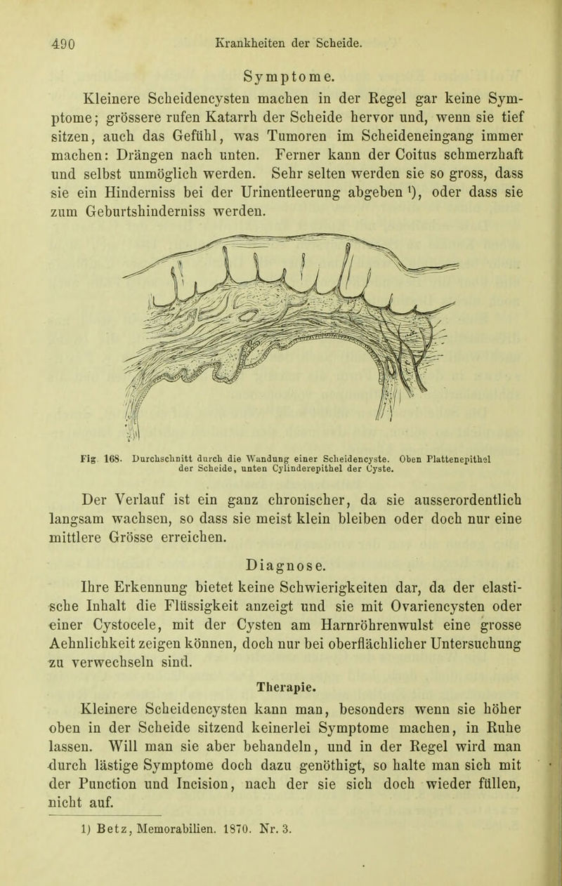 Symptome. Kleinere Scheidencysten machen in der Regel gar keine Sym- ptome; grössere rufen Katarrh der Scheide hervor und, wenn sie tief sitzen, auch das Gefühl, was Tumoren im Scheideneingang immer machen: Drängen nach unten. Ferner kann der Coitus schmerzhaft und selbst unmöglich werden. Sehr selten werden sie so gross, dass sie ein Hinderniss bei der Urinentleerung abgeben oder dass sie zum Geburtshinderniss werden. Fig. 168. Durchschnitt durch die Wandung einer Scheidencyste. Oben Plattenepithel der Scheide, unten Cylinderepithel der Cyste. Der Verlauf ist ein ganz chronischer, da sie ausserordentlich langsam wachsen, so dass sie meist klein bleiben oder doch nur eine mittlere Grösse erreichen. Diagnose. Ihre Erkennung bietet keine Schwierigkeiten dar, da der elasti- sche Inhalt die Flüssigkeit anzeigt und sie mit Ovariencysten oder einer Cystocele, mit der Cysten am Harnröhrenwulst eine grosse Aehnlichkeit zeigen können, doch nur bei oberflächlicher Untersuchung ■zu verwechseln sind. Therapie. Kleinere Scheidencysten kann man, besonders wenn sie höher oben in der Scheide sitzend keinerlei Symptome machen, in Ruhe lassen. Will man sie aber behandeln, und in der Regel wird man durch lästige Symptome doch dazu genöthigt, so halte man sich mit der Punction und Incision, nach der sie sich doch wieder füllen, nicht auf. 1) Betz, Memorabilien. 1370. Nr. 3.