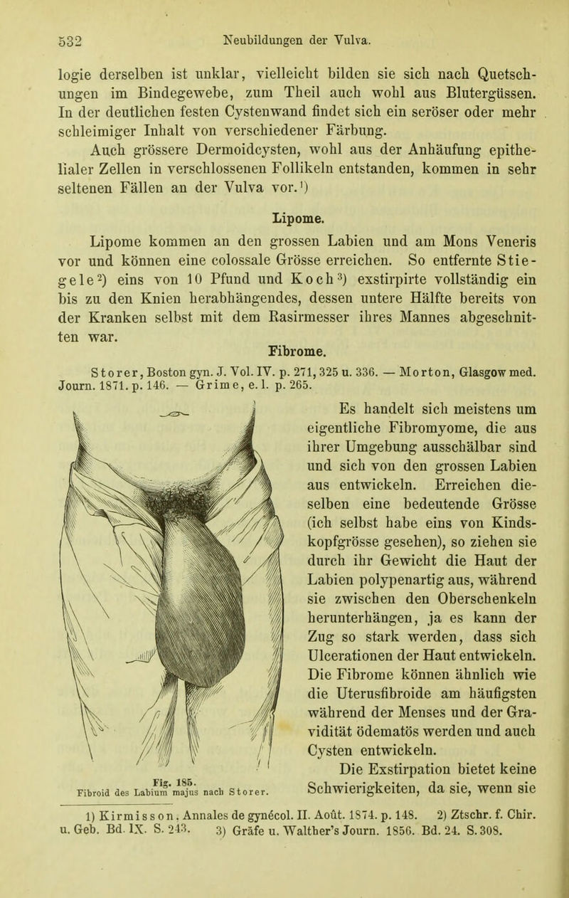 logie derselben ist unklar, vielleicht bilden sie sieb nach Quetsch- ungen im Bindegewebe, zum Tb eil auch wohl aus Blutergüssen. In der deutlichen festen Cystenwand findet sich ein seröser oder mehr schleimiger Inhalt von verschiedener Färbung. Auch grössere Dermoidcysten, wohl aus der Anhäufung epithe- lialer Zellen in verschlossenen Follikeln entstanden, kommen in sehr seltenen Fällen an der Vulva vor.') Lipome. Lipome kommen an den grossen Labien und am Möns Veneris vor und können eine colossale Grösse erreichen. So entfernte Stie- ge 1 e2) eins von 10 Pfund und Koch3) exstirpirte vollständig ein bis zu den Knien herabhängendes, dessen untere Hälfte bereits von der Kranken selbst mit dem Rasirmesser ihres Mannes abgeschnit- ten war. Fibrome. Storer,Boston gyn. J. Vol. IV. p. 271,325 u. 336. — Morton, Glasgow med. Journ. 1871. p. 146. — Grime,e. 1. p. 265. Es handelt sich meistens um eigentliche Fibromyome, die aus ihrer Umgebung ausschälbar sind und sich von den grossen Labien aus entwickeln. Erreichen die- selben eine bedeutende Grösse (ich selbst habe eins von Kinds- kopfgrösse gesehen), so ziehen sie durch ihr Gewicht die Haut der Labien polypenartig aus, während sie zwischen den Oberschenkeln herunterhängen, ja es kann der Zug so stark werden, dass sich Ulcerationen der Haut entwickeln. Die Fibrome können ähnlich wie die Uterusfibroide am häufigsten während der Menses und der Gra- vidität ödematös werden und auch Cysten entwickeln. Die Exstirpation bietet keine Schwierigkeiten, da sie, wenn sie l)Kirmisson. Annales de gynecol. II. Aoüt. 1S74. p. 148. 2) Ztschr. f. Chir. u.Geb. Bd. IX. S. 243. 3) Gräfe u. Walther's Journ. 1856. Bd. 24. S.308. Fibroid des Labium majus nach Storer.