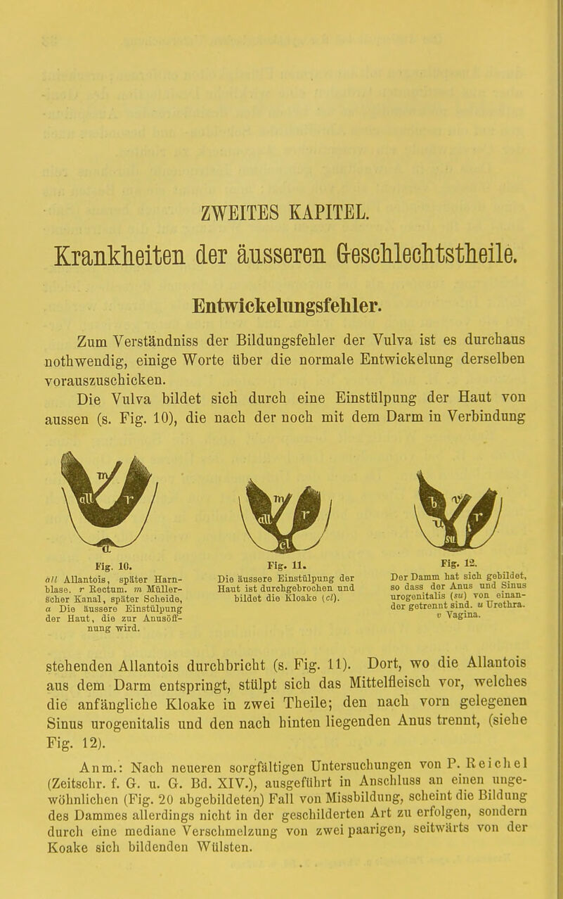 ZWEITES KAPITEL. Krankheiten der äusseren (reschlechtstheile. Entwickelungsfehler. Zum Verständniss der Bildungsfehler der Vulva ist es durchaus nothwendig, einige Worte über die normale Entwickelung derselben vorauszuschicken. Die Vulva bildet sich durch eine Einstülpung der Haut von aussen (s. Fig. 10), die nach der noch mit dem Darm in Verbindung Fig. 10. all Allantois, später Harn- blase, r Rectum, m Müller- scher Kanal, später Scheide, a Die äussere Einstülpung der Haut, die zur Anusöff- nung wird. Fig. 11. Die äussere Einstülpung der Haut ist durchgebrochen und bildet die Kloake (cl). Fig. 12. Der Damm hat sich gebildet, so dass der Anus und Sinus nrogenitalis (su) von einan- der getrennt sind, u Urethra. v Vagina. stehenden Allantois durchbricht (s. Fig. 11). Dort, wo die Allantois aus dem Darm entspringt, stülpt sich das Mittelfleisch vor, welches die anfängliche Kloake in zwei Theile; den nach vorn gelegenen Sinus urogenitalis und den nach hinten liegenden Anus trennt, (siehe Fig. 12). Anm.: Nach neueren sorgfältigen Untersuchungen von P. Reichel (Zeitschr. f. 6. u. G. Bd. XIV.), ausgeführt in Anschluss an einen unge- wöhnlichen (Fig. 20 abgebildeten) Fall von Missbildung, scheint die Bildung des Dammes allerdings nicht in der geschilderten Art zu erfolgen, sondern durch eine mediane Verschmelzung von zwei paarigen, seitwärts von der Koake sich bildenden Wülsten.