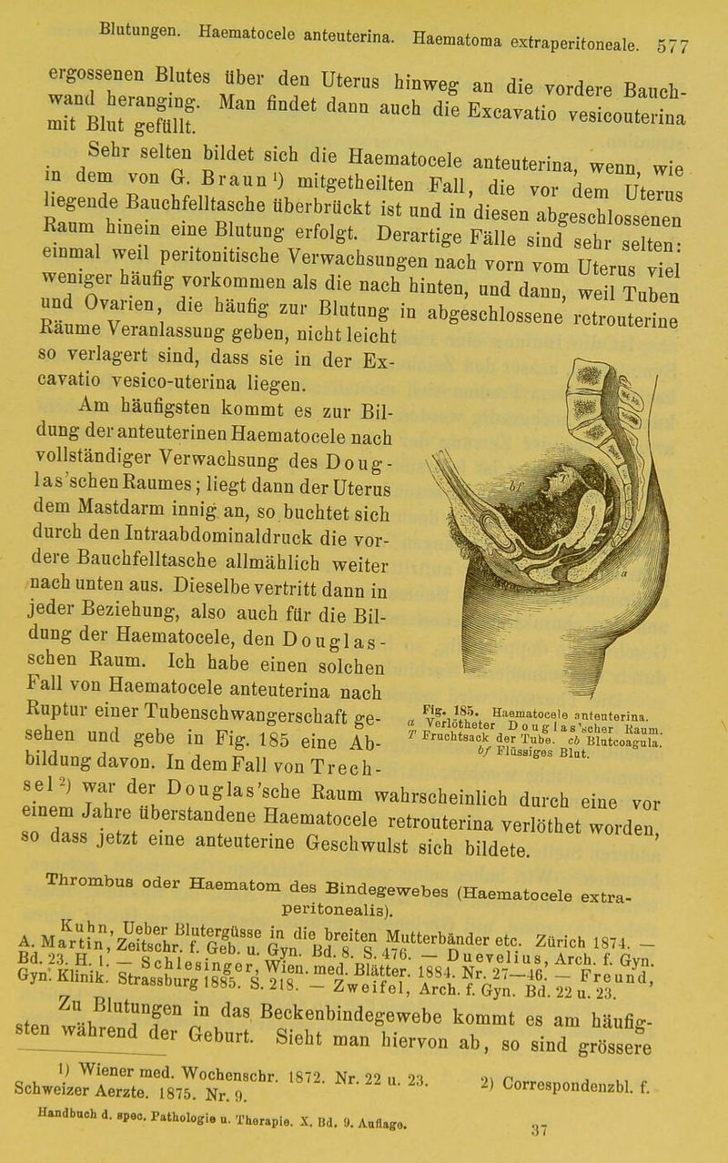 ergossenen Blutes über den Uterus hinweg an die vordere Bauch Sehr selten bildet sich die Haematocele anteuterina, wenn wie 7 r ?;^aUnl) mit^ethei1^ Fall, die vor dem Utem hegende Bauchfelltasche überbrückt ist und in diesen abgeschlossenen Raum hinein eine Blutung erfolgt. Derartige Fälle sind seh s Iten einmal weil peritonitische Verwachsungen nach vorn vom Uterus viel' weniger häufig vorkommen als die nach hinten, und dann, weil Tuben und Ovarien die häufig zur Blutung in abgeschlossene^ retr u erine Baume Veranlassung geben, nicht leicht uwnne so verlagert sind, dass sie in der Ex- cavatio vesico-uterina liegen. Am häufigsten kommt es zur Bil- dung der anteuterinen Haematocele nach vollständiger Verwachsung des Doug- las'sehen Raumes ; liegt dann der Uterus dem Mastdarm innig an, so buchtet sich durch den Intraabdominaldruck die vor- dere Bauchfelltasche allmählich weiter nach unten aus. Dieselbe vertritt dann in jeder Beziehung, also auch für die Bil- dung der Haematocele, den Douglas- schen Baum. Ich habe einen solchen Fall von Haematocele anteuterina nach Ruptur einer Tubenschwangerschaft ge- sehen und gebe in Fig. 185 eine Ab- bildung davon. In dem Fall vonTrech- sePj war der Douglas'sche Raum wahrscheinlich durch eine vor einem Jahre überstandene Haematocele retrouterina verlöthet worden so dass jetzt eine anteuterine Geschwulst sich bildete. ' Thrombus oder Haematom des Bindegewebes (Haematocele extra- peritoneali3). A-Ma^^SÄ ST i%dieBdbre8iteS%'tebr-*, »HC 18,4. - n vS*1-Ä'*i Haematocele anteuterina. I Fruehtsack der Tube, cb Blutcoagula. of Flüssiges Blut. 1J Wiener med. Wochenschr. 1872. Nr. 22 u 23 bchweizer Aerzte. 1875. Nr. 9. Handbuch d. speo. Pathologie u. Therapie. X. Bd. !). Auflage. 2) Correspondenzbl. f. 37