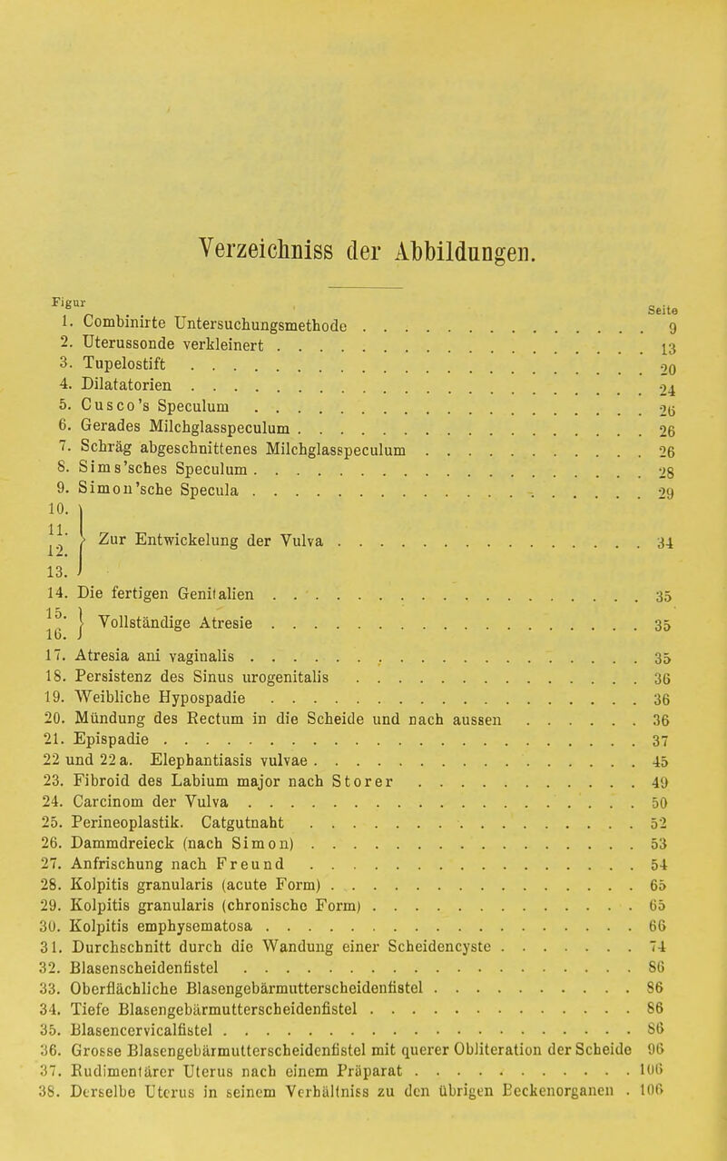 Verzeicliniss der Abbildungen. 1. Combinirte Untersuchungsmethode 9 2. üterussonde verkleinert 13 3. Tupelostift . . . . ' 20 4. Dilatatorien 24 5. Cusco's Speculuni 2(5 6. Gerades Milchglasspeculum 26 7. Schräg abgeschnittenes Milchglasspeculum 26 8. Sims'sches Speculuni 28 9. Simon'sche Specula 29 10. \ 11 ' > Zur Entwicklung der Vulva 34 13. i 14. Die fertigen Genilalien . . ' 35 15 1  > Vollständige Atresie 35 IT. Atresia ani vaginalis ....... . 35 18. Persistenz des Sinus urogenitalis 36 19. Weibliche Hypospadie 36 20. Mündung des Rectum in die Scheide und nach aussen 36 21. Epispadie 37 22 und 22 a. Elephantiasis vulvae 45 23. Fibroid des Labium major nach Storer 49 24. Carcinom der Vulva 50 25. Perineoplastik. Catgutnaht 52 26. Dammdreieck (nach Simon) 53 27. Anfrischung nach Freund 54 28. Kolpitis granularis (acute Form) 65 29. Kolpitis granularis (chronische Form) 65 30. Kolpitis emphysematosa 66 31. Durchschnitt durch die Wandung einer Scheidencyste 74 32. Blasenscheidentistel 86 33. Oberflächliche Blasengebärmutterscheidenfistel 86 34. Tiefe Blasengebärmutterscheidenfistel 86 35. Blasencervicalfistel 86 36. Grosse Blasengebärmutterscheidenfistel mit querer Obliteration der Scheide 96 37. Rudimentärer Uterus nach einem Präparat 106 38. Dtrselbe Uterus in seinem Verbällniss zu den übrigen Beckenorganen . 106
