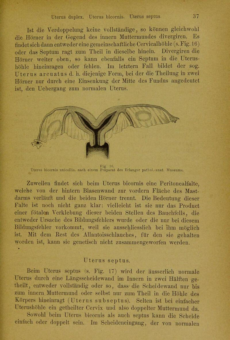 Ist die Verdoppelung- keine vollständige, so können gleichwohl die Hörner in der Gegend des Innern Muttermundes divergiren. Es findet sich dann entweder eine gemeinschaftliche Cervicalhöhle (s. Fig. 16) oder das Septum ragt zum Theil in dieselbe hinein. Divergiren die Hörner weiter oben, so kann ebenfalls ein Septum in die Uterus- höhle hineinragen oder fehlen. Im letztern Fall bildet der sog. Uterus arcuatus d. h. diejenige Form, bei der die Theilung in zwei Hörner nur durch eine Einsenkung der Mitte des Fundus angedeutet ist, den Uebergang zum normalen Uterus. Fig. Utenis bicornis unicollis, nach einem Präparat des Erlanger pathol.-anat. Museums. Zuweilen findet sich beim Uterus bicornis eine Peritonealfalte, welche von der hintern Blasenwand zur vordem Fläche des Mast- darms verläuft und die beiden Hörn er trennt. Die Bedeutung dieser Falte ist noch nicht ganz klar: vielleicht ist sie nur das Product einer fötalen Verklebung dieser beiden Stellen des Bauchfells, die entweder Ursache des Bildungsfehlers wurde oder die nur bei diesem Bildungsfehler vorkommt, weil sie ausschliesslich bei ihm möglich ist. Mit dem Rest des Allantoisschlauches, für den sie gehalten worden ist, kann sie genetisch nicht zusammengeworfen werden. Uterus septus. Beim Uterus septus (s. Fig. 17) wird der äusserlich normale Uterus durch eine Längsscheidewand im Innern in zwei Hälften ge- theilt, entweder vollständig oder so, dass die Scheidewand nur bis zum innern Muttermund oder selbst nur zum Theil in die Höhle des Körpers hineinragt (Uterus subseptus). Selten ist bei einfacher Uterushöhle ein getheilter Cervix und also doppelter Muttermund da. Sowohl beim Uterus bicornis als auch septus kann die Scheide einfach oder doppelt sein. Im Scheideneingang, der von normalen