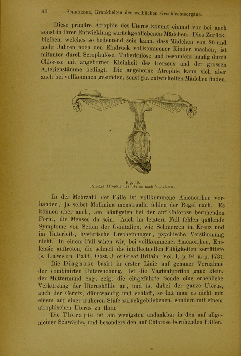 Diese primäre Atrophie des Uterus kommt einmal vor bei auch sonst in ihrer Entwicklung zurückgebliebenen Mädchen. Dies Zurück- bleiben, welches so bedeutend sein kann, dass Mädchen von 20 und mehr Jahren noch den Eindruck vollkommener Kinder machen, ist mitunter durch Scrophulose, Tuberkulose und besonders häufig durch Chlorose mit angeborner Kleinheit des Herzens und der grossen Arterienstämme bedingt. Die angeborne Atrophie kann sich aber auch bei vollkommen gesunden, sonst gut entwickelten Mädchen finden. Fig. 19. Primäre Atrophie des Uterus nach VirchoAv. In der Mehrzahl der Fälle ist vollkommene Amenorrhoe vor- handen, ja selbst Molimina menstrualia fehlen der Regel nach. Es können aber auch, am häufigsten bei der auf Chlorose beruhenden Form, die Menses da sein. Auch im letztern Fall fehlen quälende Symptome von Seiten der Genitalien, wie Schmerzen im Kreuz und im Unterleib, hysterische Erscheinungen, psychische Verstimmung nicht. In einem Fall sahen wir, bei vollkommener Amenorrhoe, Epi- lepsie auftreten, die schnell die intellectuellen Fähigkeiten zerrüttete (s. Lawson Tait, Obst. J. of Great Britain. Vol. I. p. 94 u. p. 173). Die Diagnose basirt in erster Linie auf genauer Vornahme der combinirten Untersuchung. Ist die Vaginalportion ganz klein, der Muttermund eng, zeigt die eingeführte Sonde eine erhebliche Verkürzung der üterushöhle an, und ist dabei der ganze Uterus, auch der Cervix, dünnwandig und schlaff, so hat man es nicht mit einem auf einer früheren Stufe zurückgebliebenen, sondern mit einem atrophischen Uterus zu thun. Die Therapie ist am wenigsten undankbar in den auf allge- meiner Schwäche, und besonders den auf Chlorose beruhenden Fällen.