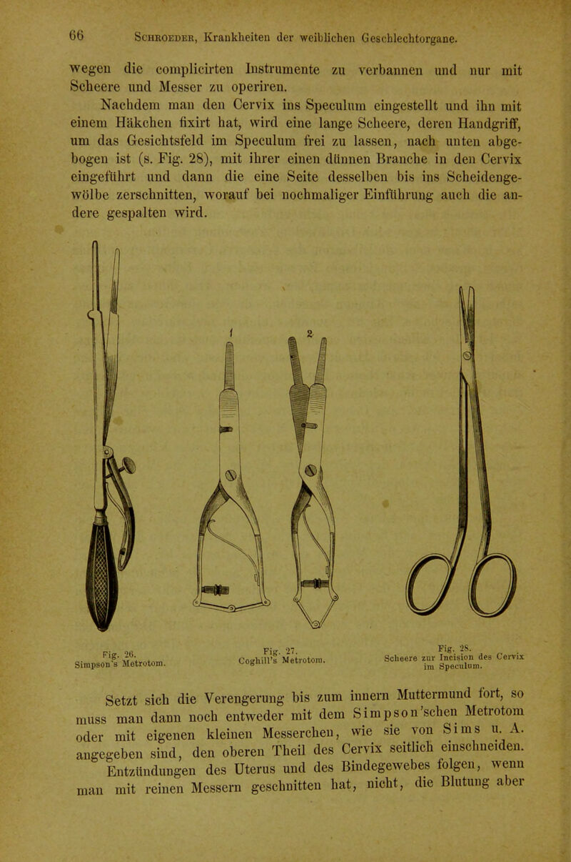 wegen die complieirten Instrumente zu verbannen und nur mit Sebeere und Messer zu operiren. Nachdem man den Cervix ins Speculum eingestellt und ihn mit einem Häkchen fixirt hat, wird eine lange Scheere, deren Handgriff, um das Gesichtsfeld im Speculum frei zu lassen, nach unten abge- bogen ist (s. Fig. 28), mit ihrer einen dünnen Branche in den Cervix eingeführt und dann die eine Seite desselben bis ins Scheidenge- wölbe zerschnitten, worauf bei nochmaliger Einführung auch die an- dere gespalten wird. Fig. 26. Simpson's Metrotom. Fig. 27. Coghill's Metrotom, Fig. 28. Scheere zur Incision des Cervix im Speculum. Setzt sich die Verengerung bis zum Innern Muttermund fort, so muss man dann noch entweder mit dem Simpson'sehen Metrotom oder mit eigenen kleinen Messerchen, wie sie von Sims u A. angegeben sind, den oberen Theil des Cervix seitlich einschneiden. Entzündungen des Uterus und des Bindegewebes folgen, wenn man mit reinen Messern geschnitten hat, nicht, die Blutung aber