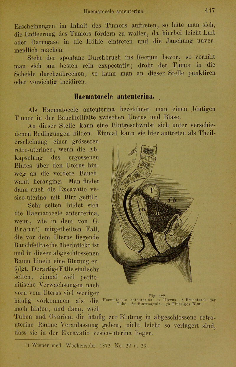 Erscheinungen im Inhalt des Tumors auftreten, so hüte man sich, die Entleerung des Tumors fördern zu wollen, da hierbei leicht Luft oder Darmgase in die Höhle eintreten und die Jauchung unver- meidlich machen. Steht der spontane Durchbruch ins Rectum bevor, so verhält man sich am besten rein exspectativ; droht der Tumor in die Scheide durchzubrechen, so kann man an dieser Stelle punktiren oder vorsichtig incidiren. Haeinatoccie anteutcriiia. Als Haematocele anteuterina bezeichnet man einen .blutigen Tumor in der Bauchfellfalte zwischen Uterus und Blase. An dieser Stelle kann eine Blutgeschwulst sich unter verschie- denen Bedingungen bilden. Einmal kann sie hier auftreten als Theil- erscheinung einer grösseren retro-uterinen, wenn die Ab- kapselung des ergossenen Blutes über den Uterus hin- weg an die vordere Bauch- wand heranging. Man findet dann auch die Excavatio ve- sico-uterina mit Blut gefüllt. Sehr selten bildet sich die Haematocele anteuterina, wenn, wie in dem von G. Braun') mitgetheilten Fall, die vor dem Uterus liegende Bauchfelltasche überbrückt ist und in diesen abgeschlossenen Raum hinein eine Blutung er- folgt. Derartige Fälle sind sehr selten, einmal weil perito- nitische Verwachsungen nach vom vom Uterus viel weniger p.^ j,, häufig vorkommen als die H«ematocele anteutcrinfi. u Uterus. < Fruclitsack der <^ Tube, bc Blutcoflgula. fb Flussiges Blut. nach hinten, und dann, weil Tuben und Ovarien, die häufig zur Blutung in abgeschlossene retro- uterine Räume Veranlassung geben, nicht leicht so verlagert sind, dass sie in der Excavatio vesico-uterina liegen. !) Wiener med. Wochenschr. 1S72. No. 22 u. 23.