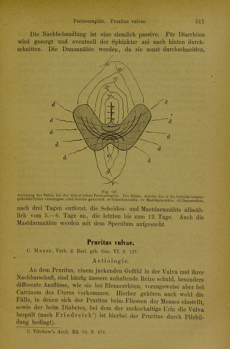 Die Nachbehandlung ist eine ziemlich passive. Für Diarrhöen wird gesorgt und eventuell der Sphinkter ani nach hinten durch- schnitten. Die Dammnähte vrerden, da sie sonst durchschneiden, Fig. 147. Anlegung der Nähte bei aei; Simon'schen Perineoraphie. Die Nähte, welche die in die Scheide hinein- gehende Spitze vereinigen, sind bereits geltnotet. OTScheideuuähte. n-Mastdarmnähte, drfDammnähte. nach drei Tagen entfernt, die Scheiden- und Mastdarmnähte allmäh- lich vom 5.-6. Tage an, die letzten bis zum 12. Tage. Auch die Mastdarmnähte werden mit dem Speculum aufgesucht. Pruritus vulvae. C. Mayer, Verh. d. Berl. geb. Ges. VI. S. 137. Aetiologie. An dem Pruritus, einem juckenden Gefühl in der Vulva und ihrer Nachbarschaft, sind häufig äussere anhaltende Kelze schuld, besonders differente Ausflüsse, wie sie bei Blennorrhöen, vorzugsweise aber bei Carcinom des Uterus vorkommen. Hierher gehören auch wohl die Fälle, in denen sich der Pruritus beim Fliessen der Menses einstellt, sowie der beim Diabetes, bei dem der zuckerhaltige Urin die Vulva bespült (nach Friedreich^ ist hierbei der Pruritus durch Pilzbil- dung bedingt). 1) Yirchow's Arch. Bd. 30. S. 47G.