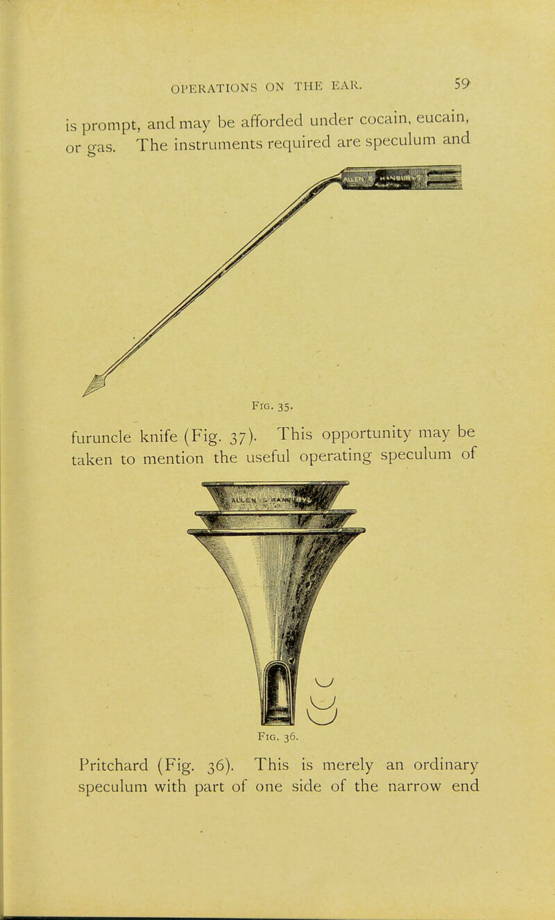 is prompt, and may be afforded under cocain, eucain, The instruments required are speculum and or gas. Frc. 35. furuncle knife (Fig. 37). This opportunity may be taken to mention the useful operating speculum of Fig. 36. Pritchard (Fig. 36). This is merely an ordinary speculum with part of one side of the narrow end