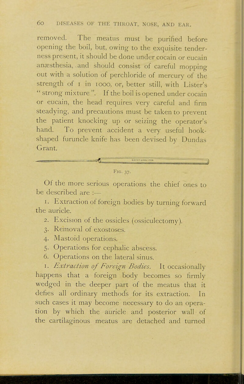 removed. The meatus must be purified before opening the boil, but, owing- to the exquisite tender- ness present, it should be done under cocain or eucain anaesthesia, and should consist of careful mopping out with a solution of perchloricle of mercury of the strength of i in iooo, or, better still, with Lister's  strong mixture . If the boil is opened under cocain or eucain, the head requires very careful and firm steadying, and precautions must be taken to prevent the patient knocking up or seizing the operator's hand. To prevent accident a very useful hook- shaped furuncle knife has been devised by Dundas Grant. MAVE!' 0(MELI7GH 3 Fig. 37. Of the more serious operations the chief ones to be described are :— 1. Extraction of foreign bodies by turning forward the auricle. 2. Excision of the ossicles (ossiculectomy). 3. Removal of exostoses. 4. Mastoid operations. 5. Operations for cephalic abscess. 6. Operations on the lateral sinus. 1. Extraction of Foreign Bodies. It occasionally happens that a foreign body becomes so firmly wedged in the deeper part of the meatus that it defies all ordinary methods for its extraction. In such cases it may become necessary to do an opera- tion by which the auricle and posterior wall of the cartilaginous meatus are detached and turned