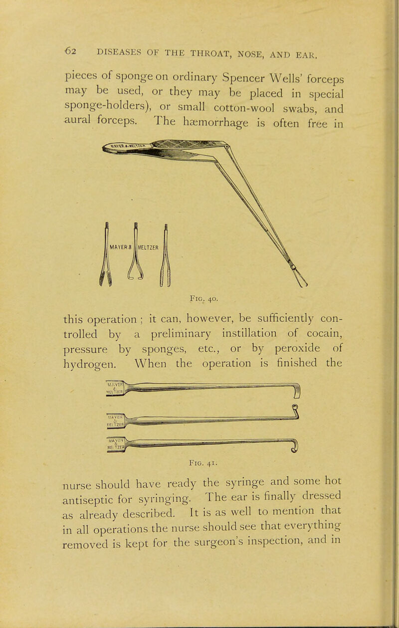 pieces of sponge on ordinary Spencer Wells' forceps may be used, or they may be placed in special sponge-holders), or small cotton-wool swabs, and aural forceps. The haemorrhage is often free in Fig. 40. this operation ; it can, however, be sufficiently con- trolled by a preliminary instillation of cocain, pressure by sponges, etc., or by peroxide of hydrogen. When the operation is finished the Fig. 41. nurse should have ready the syringe and some hot antiseptic for syringing. The ear is finally dressed as already described. It is as well to mention that in all operations the nurse should see that everything removed is kept for the surgeon's inspection, and in