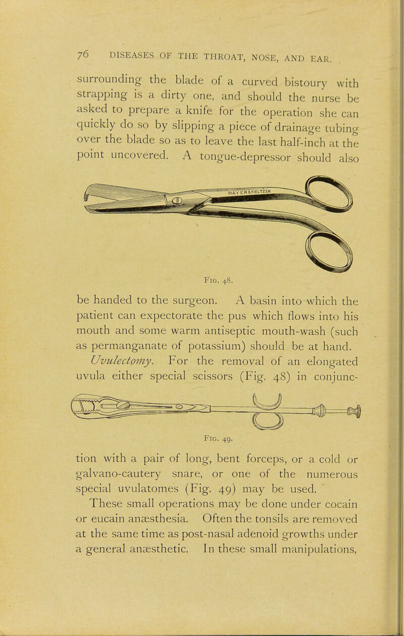 surrounding the blade of a curved bistoury with strapping is a dirty one, and should the nurse be asked to prepare a knife for the operation she can quickly do so by slipping a piece of drainage tubing over the blade so as to leave the last half-inch at the point uncovered. A tongue-depressor should also Fig. 48. be handed to the surgeon. A basin into which the patient can expectorate the pus which flows into his mouth and some warm antiseptic mouth-wash (such as permanganate of potassium) should be at hand. Uvulectomy. For the removal of an elongated uvula either special scissors (Fig. 48) in conjunc- Fig. 4g. tion with a pair of long, bent forceps, or a cold or galvano-cautery snare, or one of the numerous special uvulatomes (Fig. 49) may be used. These small operations may be done under cocain or eucain anaesthesia. Often the tonsils are removed at the same time as post-nasal adenoid growths under a general anaesthetic. In these small manipulations,