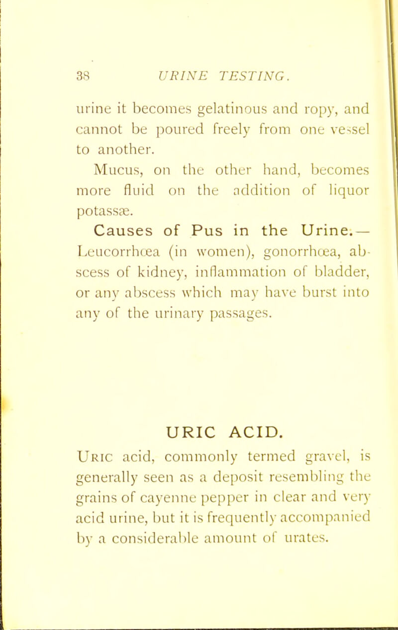 urine it becomes gelatinous and ropy, and cannot be poured freely from one vessel to another. Mucus, on the other hand, becomes more fluid on the addition of liquor potassEe. Causes of Pus in the Urine.— I.eucorrhcea (in women), gonorrhtea, ab- scess of kidney, inflammation of bladder, or any abscess which may have burst into any of the urinary passages. URIC ACID. Uric acid, commonly termed gravel, is generally seen as a deposit resembling the grains of cayenne pepper in clear and very acid urine, but it is frequently accompanied by a considerable amount of urates.