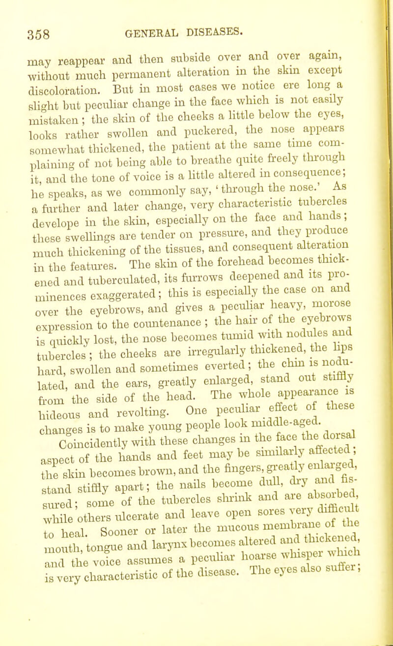 may reappear and then subside over and over again, without much permanent alteration in the skin except discoloration. But in most cases we notice ere long a slight but peculiar change in the face which is not easily mistaken ; the skin of the cheeks a little below the eyes, looks rather swollen and puckered, the nose appears somewhat thickened, the patient at the same time com- plaining of not being able to breathe quite freely through it and the tone of voice is a little altered in consequence; he speaks, as we commonly say, ' through the nose.' As a further and later change, very characteristic tubercles develope in the skin, especially on the face and hands; these swellings are tender on pressure, and they produce much thickening of the tissues, and consequent alteration in the features. The skin of the forehead becomes thick- ened and tuberculated, its furrows deepened and its pro- minences exaggerated; this is especially the case on and over the eyebrows, and gives a peculiar heavy, morose expression to the countenance ; the hair of the eyebrows is quickly lost, the nose becomes tumid with nodules and tubercles ; the cheeks are irregularly th darned, the hps hard, swollen and sometimes everted; the chin is nodu- lated, and the ears, greatly enlarged stand out s rffly from the side of the head. The whole appearance « Sous and revolting. One peculiar effect of these changes is to make young people look middle Confidently with these changes m the face the dorsal aspect of the hands and feet may be similarly affected the skin becomes brown, and the fingers, greatly enlarged, stand stiffly apart; the nails become dull, dry and fis- sm d; some of the tubercles shrink and are absorbed Xe others ulcerate and leave open sores very dhhcffl toheal. Sooner or later the mucous membrane of the mouth tongue and larynx becomes altered and thickened 3 the voice assumes a peculiar hoarse whisper which very characteristic of the disease. The eyes also suffer,