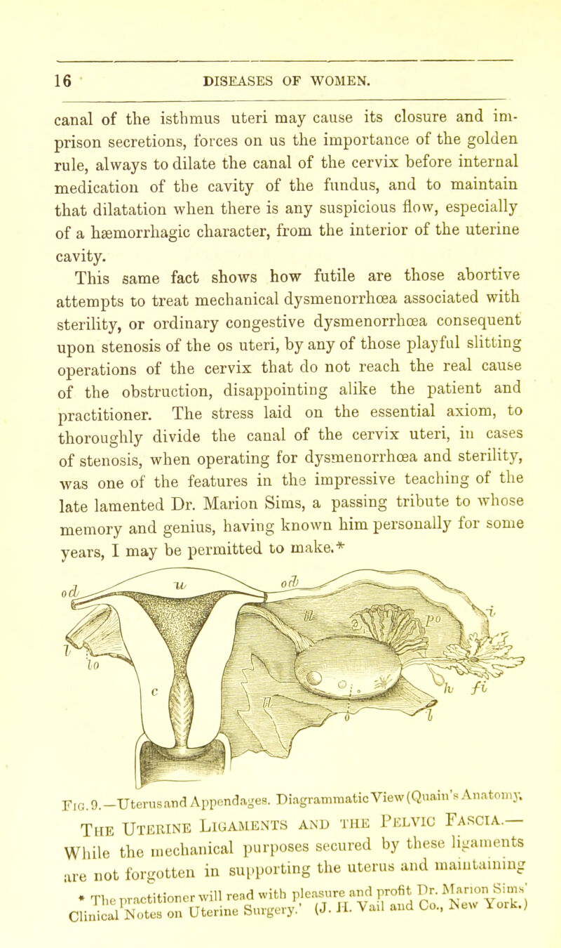 canal of the isthmus uteri may cause its closure and im- prison secretions, forces on us the importance of the golden rule, always to dilate the canal of the cervix before internal medication of the cavity of the fundus, and to maintain that dilatation when there is any suspicious flow, especially of a hemorrhagic character, from the interior of the uterine cavity. This same fact shows how futile are those abortive attempts to treat mechanical dysmenorrhcea associated with sterility, or ordinary congestive dysmenorrhcea consequent upon stenosis of the os uteri, by any of those playful slitting operations of the cervix that do not reach the real cause of the obstruction, disappointing alike the patient and practitioner. The stress laid on the essential axiom, to thoroughly divide the canal of the cervix uteri, in cases of stenosis, when operating for dysmenorrhcea and sterility, was one of the features in the impressive teaching of the late lamented Dr. Marion Sims, a passing tribute to whose memory and genius, having known him personally for some years, I may be permitted to make.* orb FlG.Q.-TJterusandAppendages. Diagrammatic View (Quain's Anatomy. The Uterine Ligaments and the Pelvic Fascia.— While the mechanical purposes secured by these ligaments are not forgotten in supporting the uterus and maintaining ' ♦ The practitioner will read with pleasure and profit Dr. Marion Sims' ClinkSteB on Uterine Surgery.' (J. H. Vail and Co., New York.,