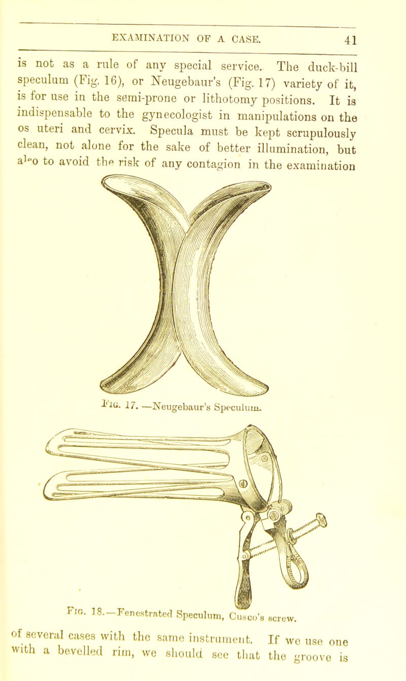 is not as a rule of any special service. The duck-bill speculum (Fig. 16), or Neugebaur's (Fig. 17) variety of it, is for use in the semi-prone or lithotomy positions. It is indispensable to the gynecologist in manipulations on the os uteri and cervix. Specula must be kept scrupulously clean, not alone for the sake of better illumination, but aJ-o to avoid the risk of any contagion in the examination several cases with the same instrument. If we us th a bevelled rim, we should see that the gro(