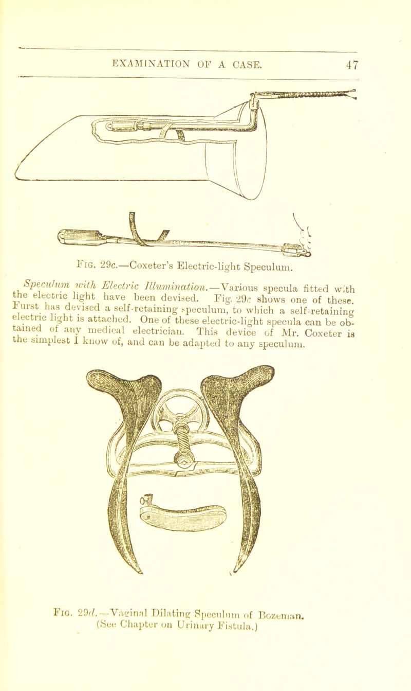 Fig. 29c.—Coxeter's Electric-light Speculum. Speculum with Electric Illumination.— Various specula fitted with the electric light have been devised. Fig. 29c shows one of these. *urst has devised a self-retaining speculum, to which a self-retaining electric light is attached. One of these electric-light specula can be ob- tained of any medical electrician. This device of Mr. Coxeter is the simplest I know of, and can be adapted to any speculum. Via. 2<3d.~Vaeinal Dilating Speculum of Bozeman. (Sec Chapter on Urinary Fistula.)