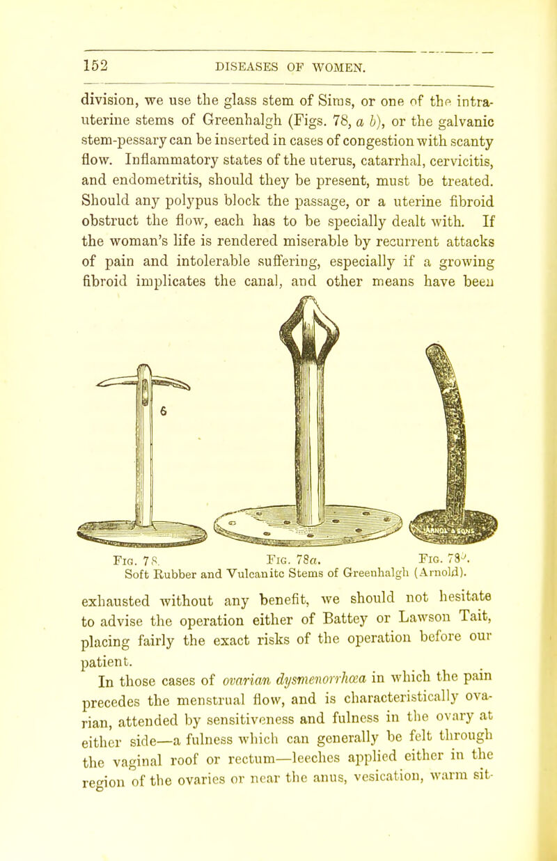 division, we use the glass stem of Sims, or one of the intra- uterine stems of Greenhalgh (Figs. 78, a b), or the galvanic stem-pessary can be inserted in cases of congestion with scanty- flow. Inflammatory states of the uterus, catarrhal, cervicitis, and endometritis, should they be present, must be treated. Should any polypus block the passage, or a uterine fibroid obstruct the flow, each has to be specially dealt with. If the woman's life is rendered miserable by recurrent attacks of pain and intolerable suffering, especially if a growing fibroid implicates the canal, and other means have been Fig. 78. Fig. 78a. Fig. 78^. Soft Rubber and Vulcanite Stems of Greenhalgh (Arnold). exhausted without any benefit, we should not hesitate to advise the operation either of Battey or Lawson Tait, placing fairly the exact risks of the operation before our patient. In those cases of ovarian dysmenorrhea in which the pain precedes the menstrual flow, and is characteristically ova- rian, attended by sensitiveness and fulness in the ovary at either side—a fulness which can generally be felt through the vaginal roof or rectum—leeches applied either in the region of the ovaries or near the anus, vesication, warm sit-
