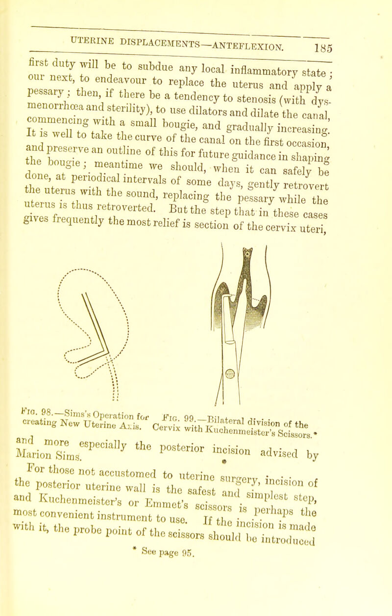 ntf I1 ^ t0 SUMue anyl0Cal -flammatory state; P« tlT fTU\t0 ^ the UterUS apply a pessary then if there be a tendency to stenosis (with dys- menorrhea and sterility), to use dilators and dilate the can a i~Ut!T« Sma11 b°Ugie' —y incre^g: It s well to take the curve of the canal on the first occasion lone n § '-Tai; ^ WQ Sh0Uld' When ifc can safely be one at periodical intervals of some days, gently retrovert the uterus with the sound, replacing the pe^sary^h ]e the uterus is thus retroverted. But the step that in these case gives frequently the most relief is section of the cervix uter Kio 98.—Sims's Operation for Fig 99 P;inf0 i • . uLTiL' 1MStOTi0r advised bv For those not accustomed to uterine eurm™ ;„ • ■ , the posterior nterine wall is the safest ' T T' °f and Kuchenmeister's or Z^^LTi^T most convenient instrument to use 72 in .* ««. *«- probe Point;f thescisJlh^:;;:^'; * See page 95.