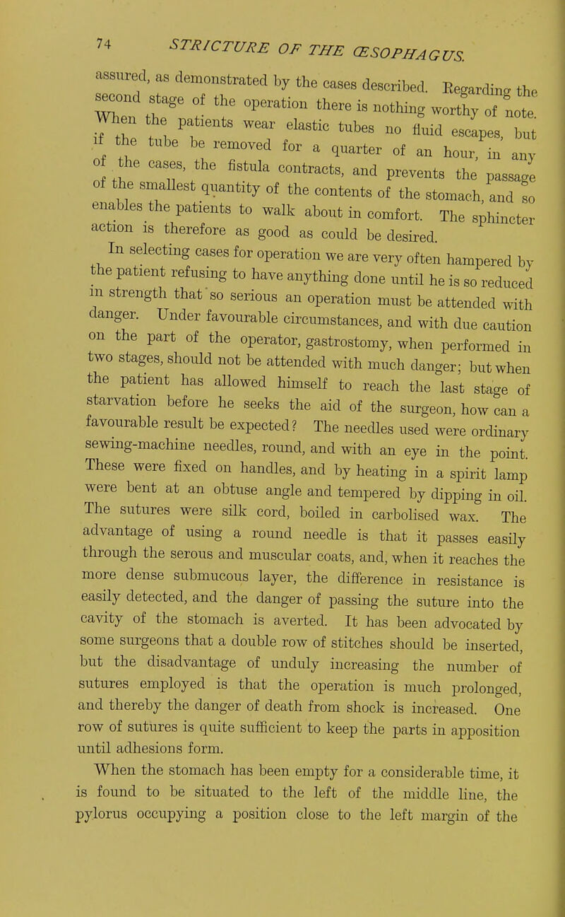 assured, as demonstrated by the cases described. Regarding the second stage of the operation there is nothing When th „ wear elast.c tubeg no ^ J ota the tube be amoved for a quarter of an hour in any th ' T\ fiStUk C°ntraCtS' aUd ~s the P—ge of the smallest quantity of the contents of the stomach, and so enables the patients to walk about in comfort. The sphincter action is therefore as good as could be desired In selecting cases for operation we are very often hampered by the patient refusing to have anything done until he is so reduced m strength that so serious an operation must be attended with danger. Under favourable circumstances, and with due caution on the part of the operator, gastrostomy, when performed in two stages, should not be attended with much danger; but when the patient has allowed himself to reach the last stage of starvation before he seeks the aid of the surgeon, how can a favourable result be expected? The needles used were ordinary sewing-machine needles, round, and with an eye in the point These were fixed on handles, and by heating in a spirit lamp were bent at an obtuse angle and tempered by dipping in oil. The sutures were silk cord, boiled in carbolised wax. The advantage of using a round needle is that it passes easily through the serous and muscular coats, and, when it reaches the more dense submucous layer, the difference in resistance is easily detected, and the danger of passing the suture into the cavity of the stomach is averted. It has been advocated by some surgeons that a double row of stitches should be inserted, but the disadvantage of unduly increasing the number of sutures employed is that the operation is much prolonged, and thereby the danger of death from shock is increased. One row of sutures is quite sufficient to keep the parts in apposition until adhesions form. When the stomach has been empty for a considerable time, it is found to be situated to the left of the middle line, the pylorus occupying a position close to the left margin of the